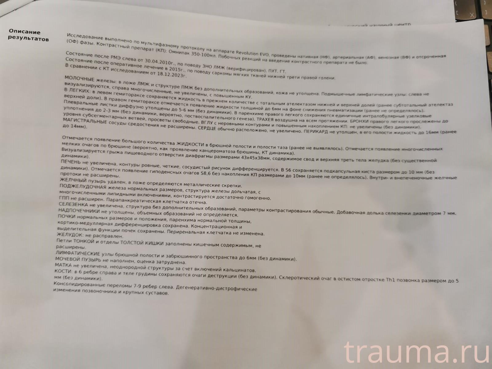 Рентген на дому: по вашему адресу приезжает врач-рентгенолог, травматолог-ортопед с мобильным рентгеновским аппаратом, проводит диагностику травмы или заболевания, делает необходимые рентгенограммы, дает рекомендации по дальнейшему лечению. Получить качественные снимки в домашних условиях возможно благодаря уникальной методике, разработанной МосРентген Центром для института  Склифосовского