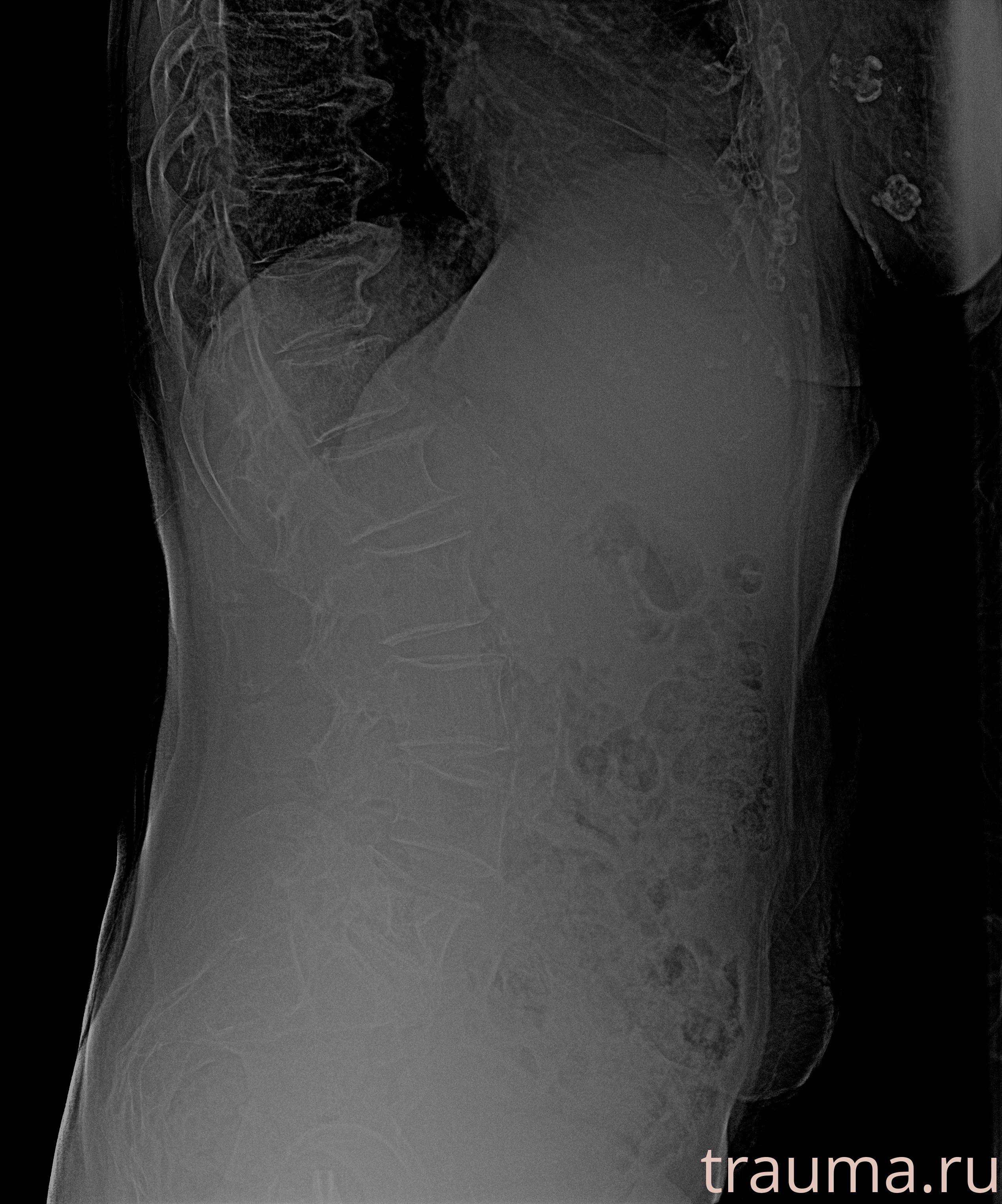 Рентген на дому: по вашему адресу приезжает врач-рентгенолог, травматолог-ортопед с мобильным рентгеновским аппаратом, проводит диагностику травмы или заболевания, делает необходимые рентгенограммы, дает рекомендации по дальнейшему лечению. Получить качественные снимки в домашних условиях возможно благодаря уникальной методике, разработанной МосРентген Центром для института  Склифосовского