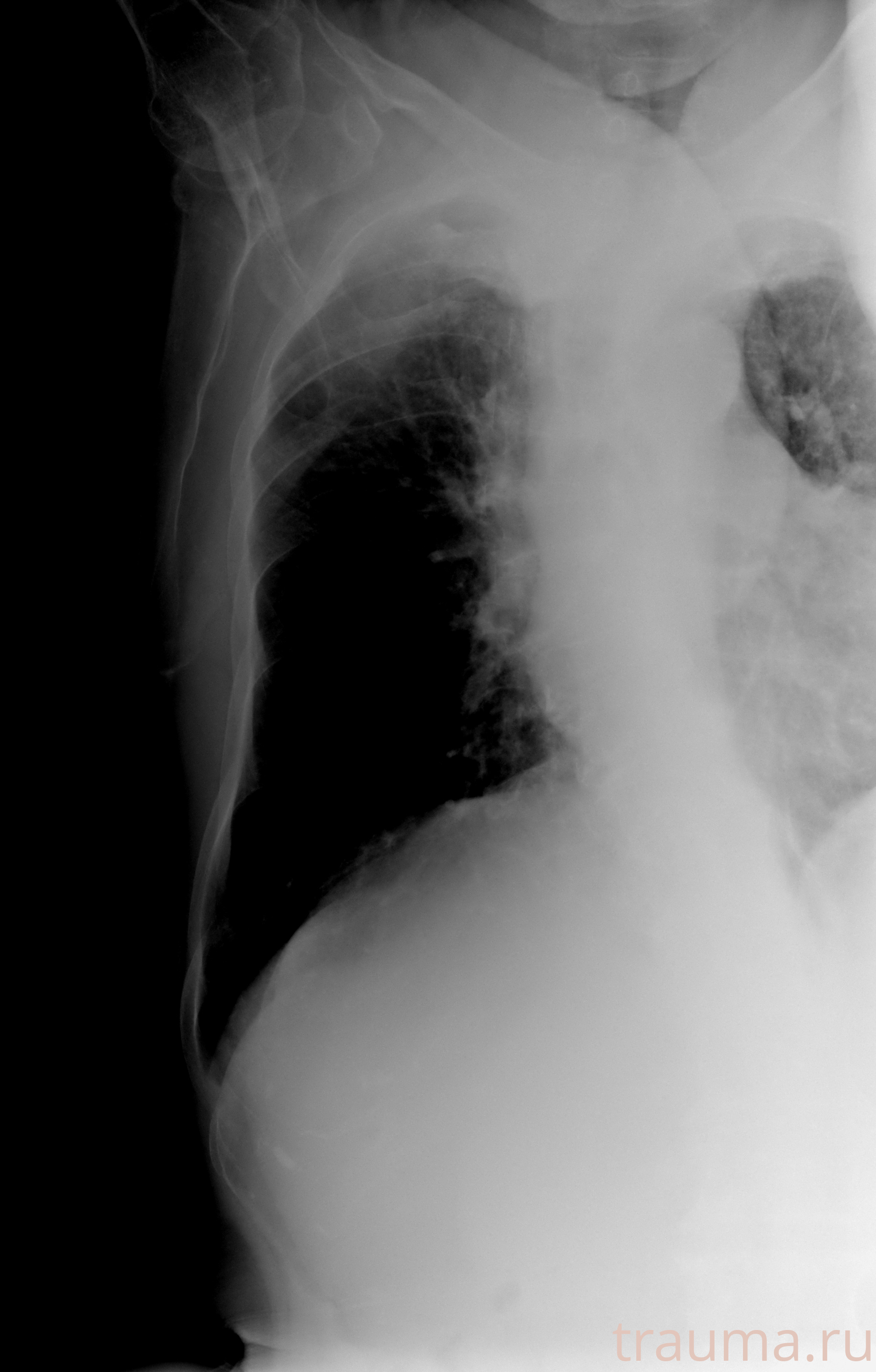 Рентген на дому: по вашему адресу приезжает врач-рентгенолог, травматолог-ортопед с мобильным рентгеновским аппаратом, проводит диагностику травмы или заболевания, делает необходимые рентгенограммы, дает рекомендации по дальнейшему лечению. Получить качественные снимки в домашних условиях возможно благодаря уникальной методике, разработанной МосРентген Центром для института  Склифосовского