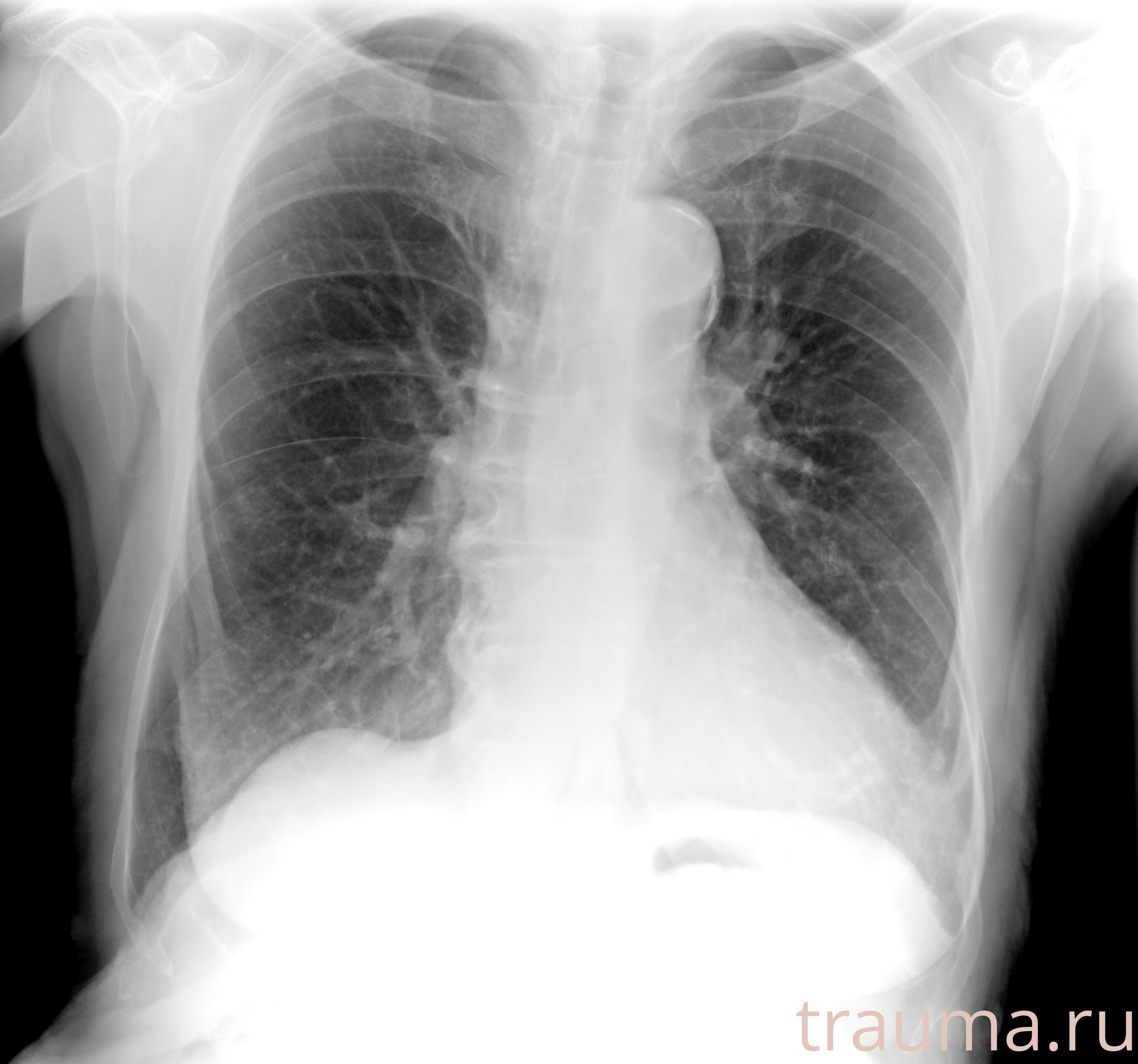 Рентген на дому: по вашему адресу приезжает врач-рентгенолог, травматолог-ортопед с мобильным рентгеновским аппаратом, проводит диагностику травмы или заболевания, делает необходимые рентгенограммы, дает рекомендации по дальнейшему лечению. Получить качественные снимки в домашних условиях возможно благодаря уникальной методике, разработанной МосРентген Центром для института  Склифосовского