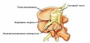 позвоночник,ренген позвоночник,ренген