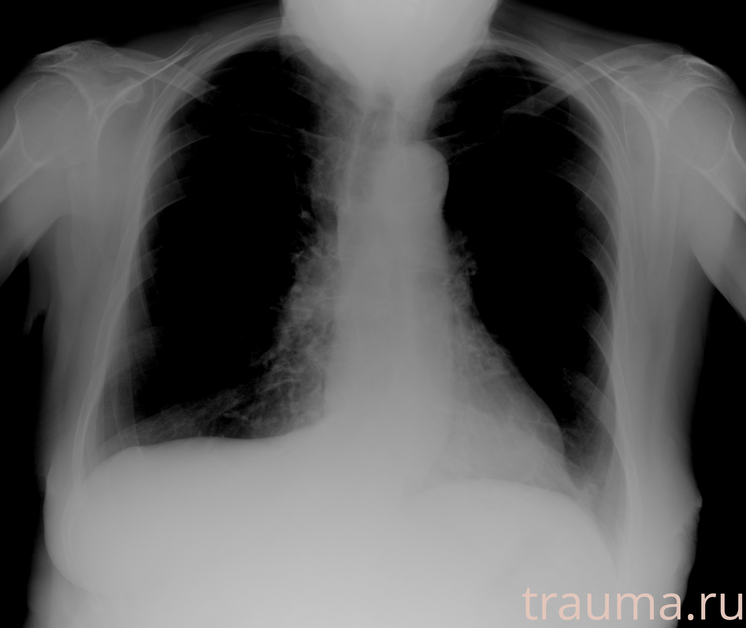 Рентген на дому: по вашему адресу приезжает врач-рентгенолог, травматолог-ортопед с мобильным рентгеновским аппаратом, проводит диагностику травмы или заболевания, делает необходимые рентгенограммы, дает рекомендации по дальнейшему лечению. Получить качественные снимки в домашних условиях возможно благодаря уникальной методике, разработанной МосРентген Центром для института  Склифосовского