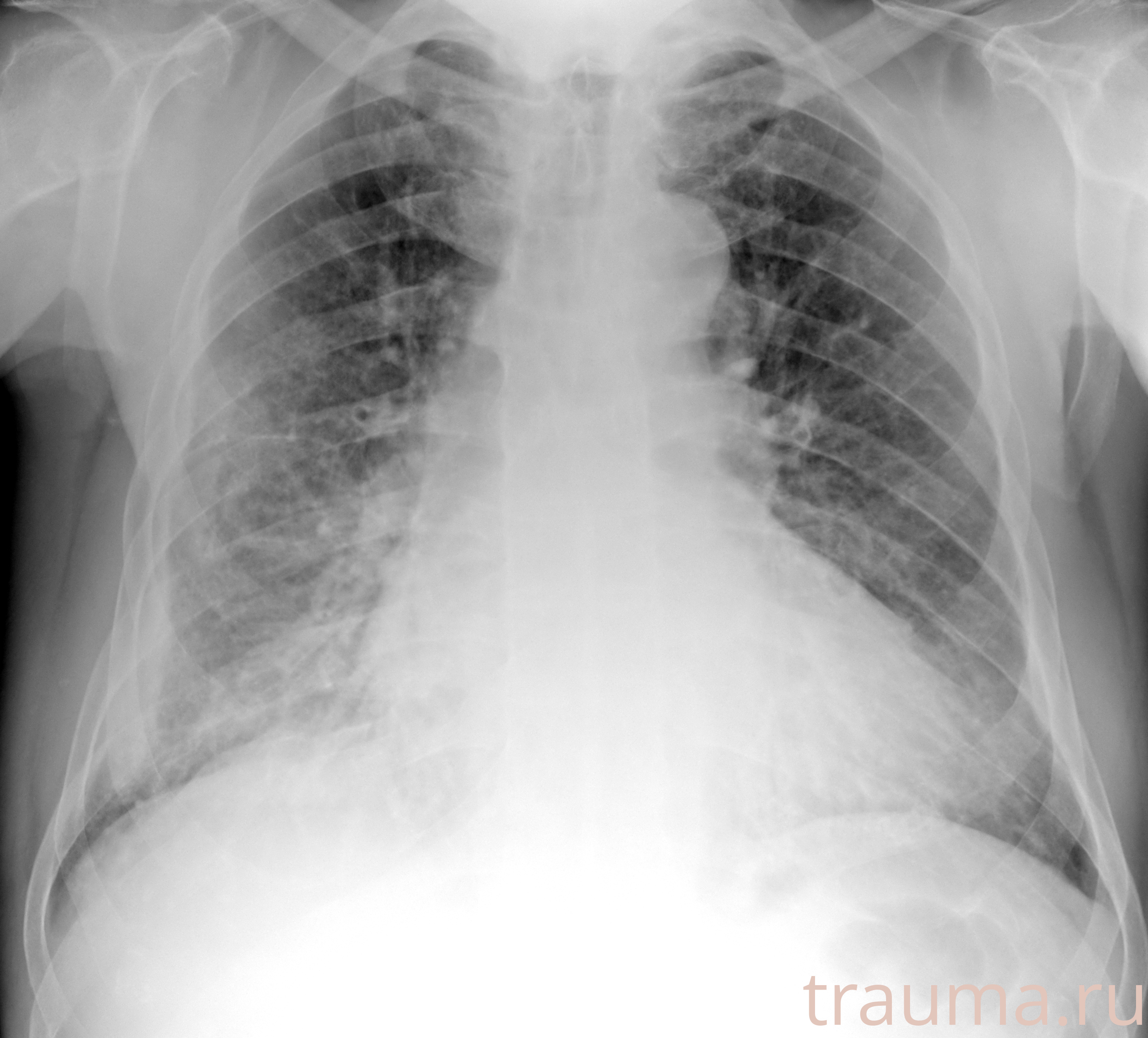 Рентген на дому: по вашему адресу приезжает врач-рентгенолог, травматолог-ортопед с мобильным рентгеновским аппаратом, проводит диагностику травмы или заболевания, делает необходимые рентгенограммы, дает рекомендации по дальнейшему лечению. Получить качественные снимки в домашних условиях возможно благодаря уникальной методике, разработанной МосРентген Центром для института  Склифосовского