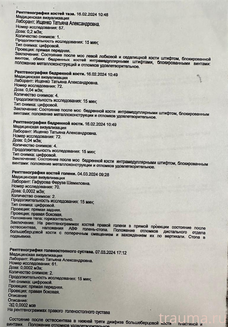 Рентген на дому: по вашему адресу приезжает врач-рентгенолог, травматолог-ортопед с мобильным рентгеновским аппаратом, проводит диагностику травмы или заболевания, делает необходимые рентгенограммы, дает рекомендации по дальнейшему лечению. Получить качественные снимки в домашних условиях возможно благодаря уникальной методике, разработанной МосРентген Центром для института  Склифосовского