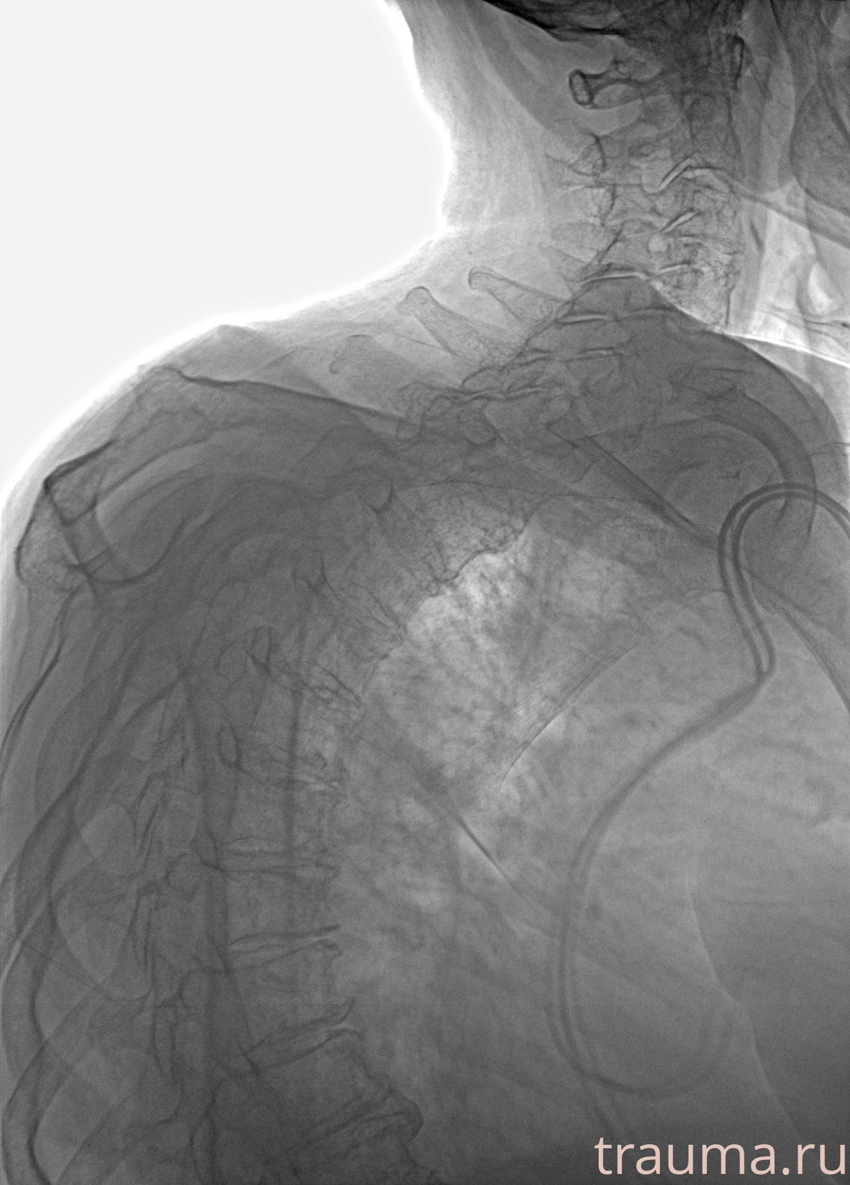 Рентген на дому: по вашему адресу приезжает врач-рентгенолог, травматолог-ортопед с мобильным рентгеновским аппаратом, проводит диагностику травмы или заболевания, делает необходимые рентгенограммы, дает рекомендации по дальнейшему лечению. Получить качественные снимки в домашних условиях возможно благодаря уникальной методике, разработанной МосРентген Центром для института  Склифосовского