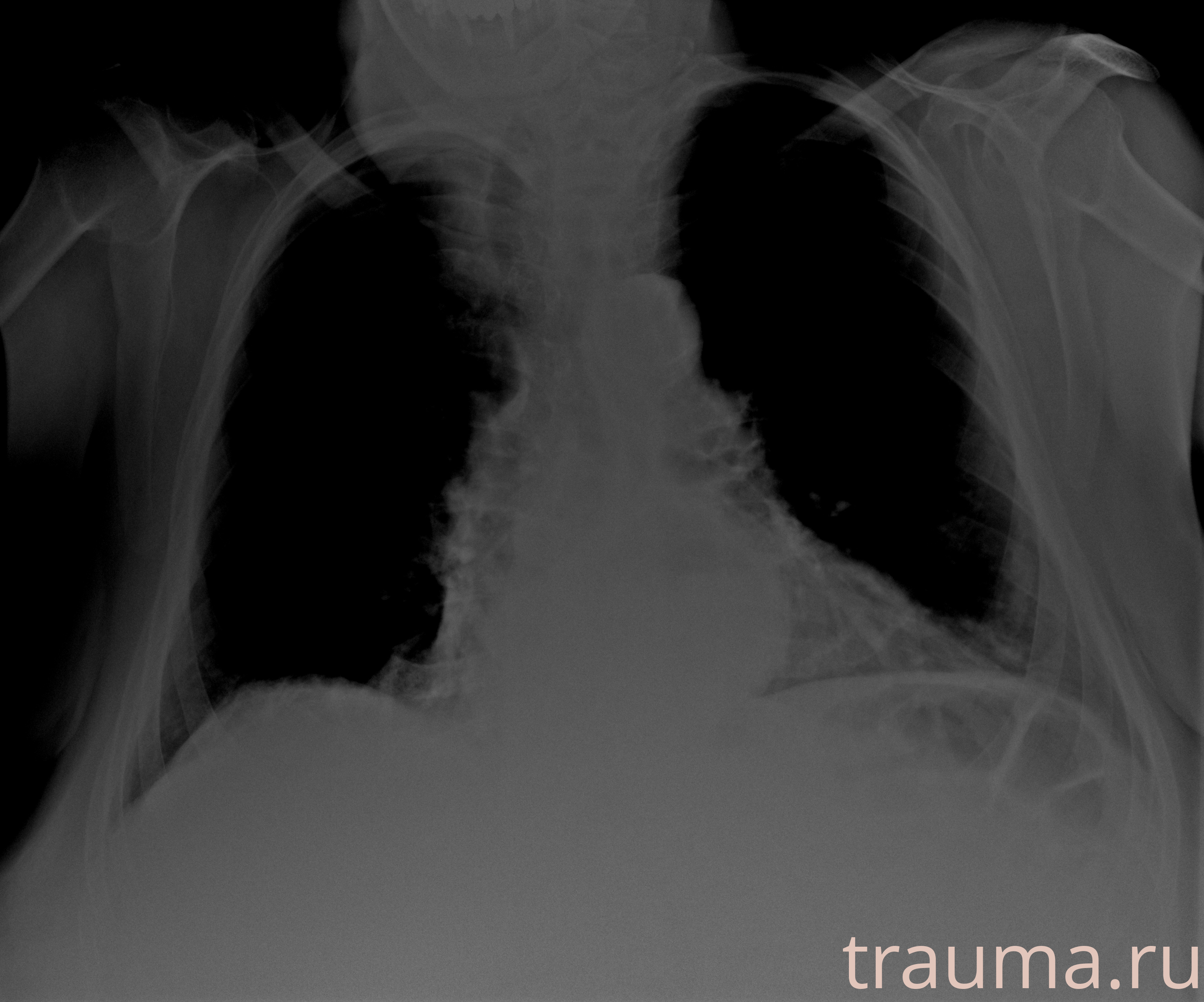 Рентген на дому: по вашему адресу приезжает врач-рентгенолог, травматолог-ортопед с мобильным рентгеновским аппаратом, проводит диагностику травмы или заболевания, делает необходимые рентгенограммы, дает рекомендации по дальнейшему лечению. Получить качественные снимки в домашних условиях возможно благодаря уникальной методике, разработанной МосРентген Центром для института  Склифосовского
