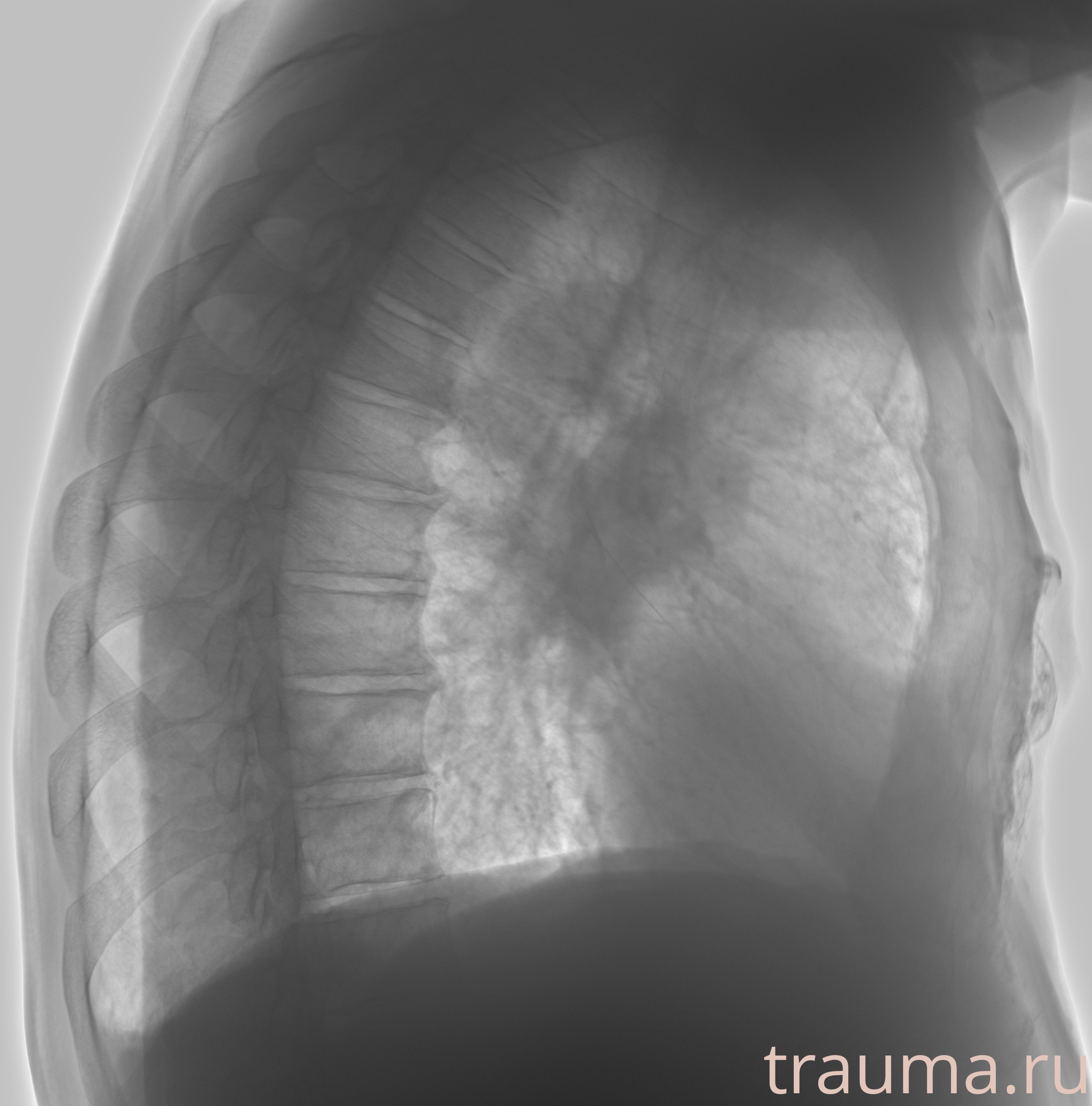 Рентген на дому: по вашему адресу приезжает врач-рентгенолог, травматолог-ортопед с мобильным рентгеновским аппаратом, проводит диагностику травмы или заболевания, делает необходимые рентгенограммы, дает рекомендации по дальнейшему лечению. Получить качественные снимки в домашних условиях возможно благодаря уникальной методике, разработанной МосРентген Центром для института  Склифосовского