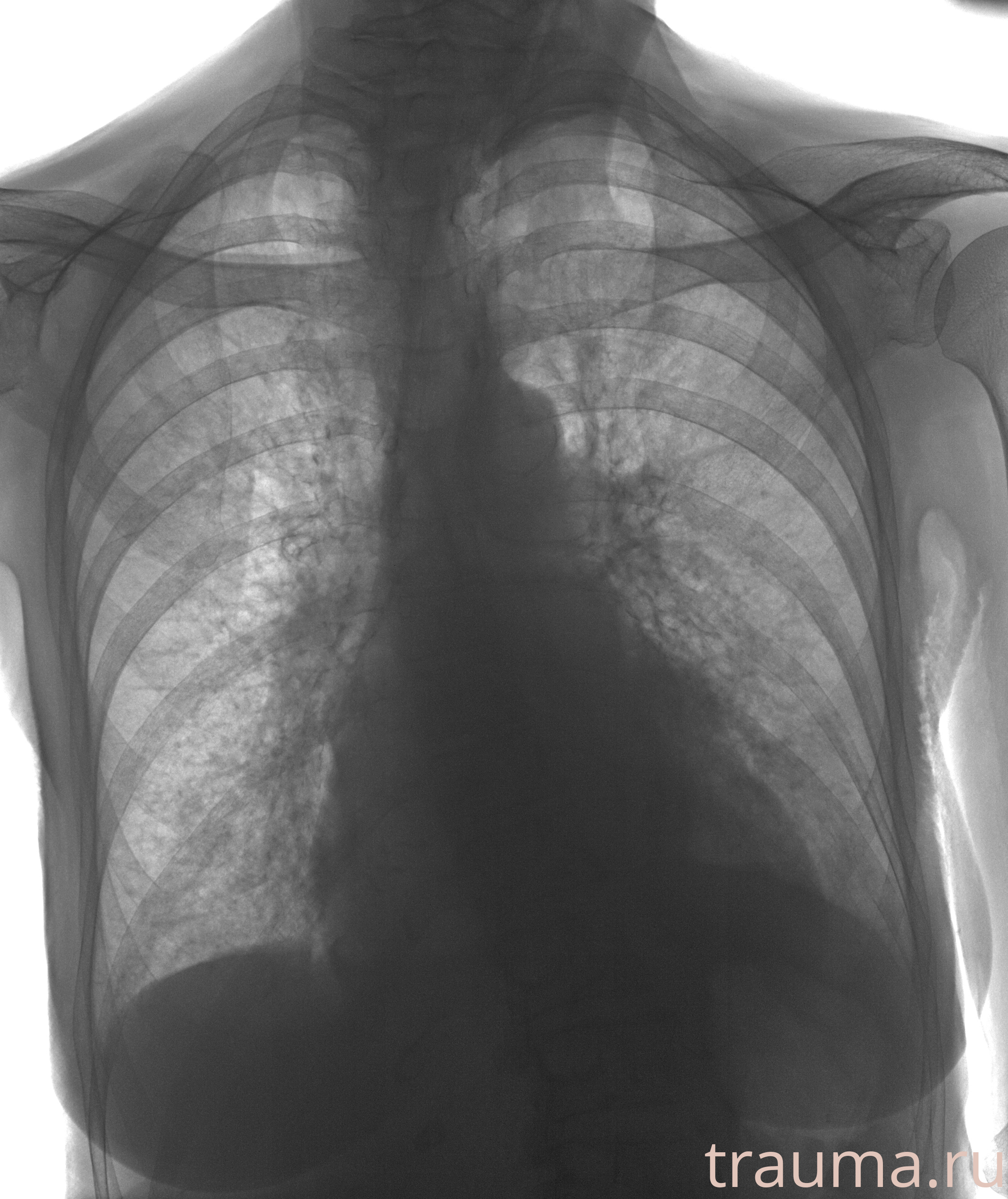 Рентген на дому: по вашему адресу приезжает врач-рентгенолог, травматолог-ортопед с мобильным рентгеновским аппаратом, проводит диагностику травмы или заболевания, делает необходимые рентгенограммы, дает рекомендации по дальнейшему лечению. Получить качественные снимки в домашних условиях возможно благодаря уникальной методике, разработанной МосРентген Центром для института  Склифосовского