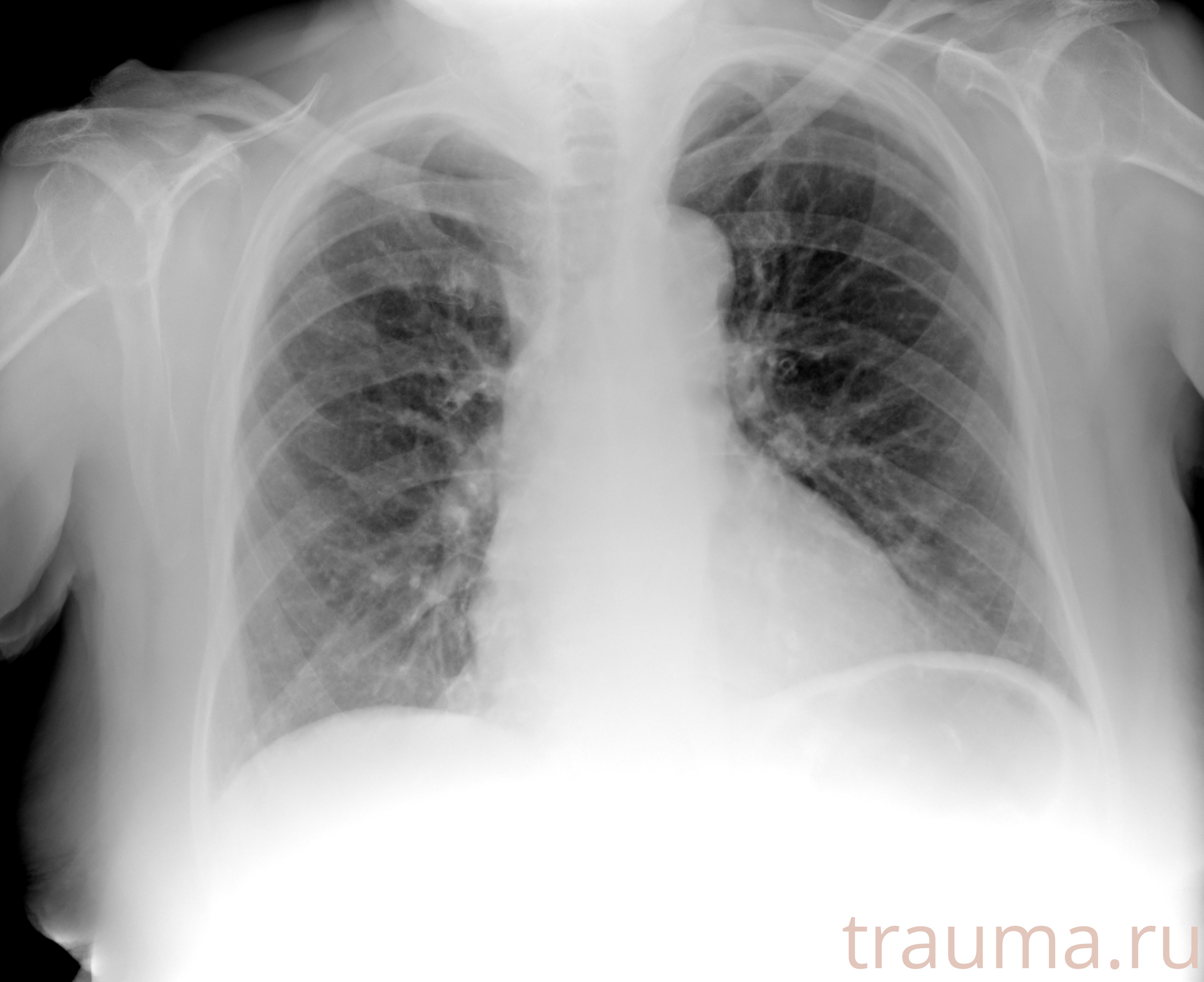 Рентген на дому: по вашему адресу приезжает врач-рентгенолог, травматолог-ортопед с мобильным рентгеновским аппаратом, проводит диагностику травмы или заболевания, делает необходимые рентгенограммы, дает рекомендации по дальнейшему лечению. Получить качественные снимки в домашних условиях возможно благодаря уникальной методике, разработанной МосРентген Центром для института  Склифосовского