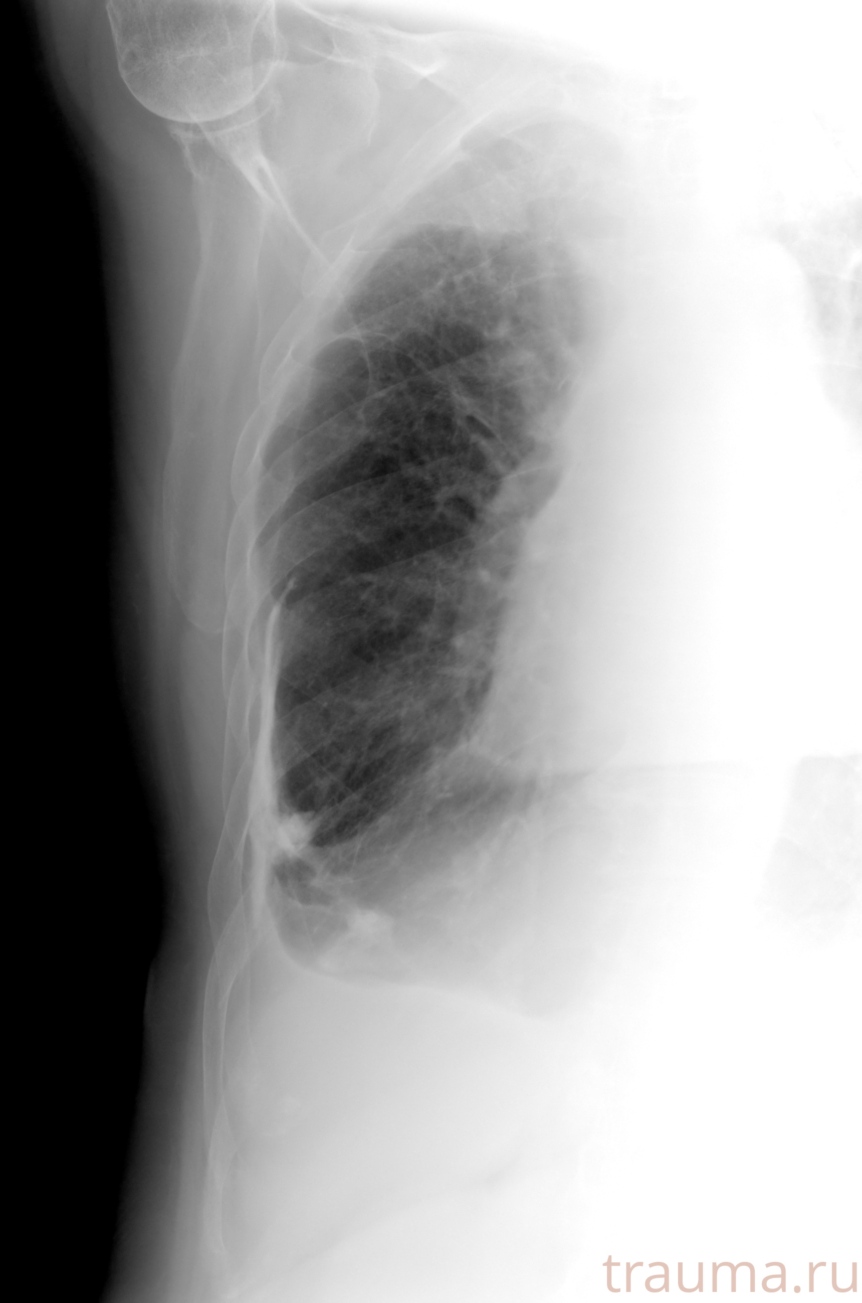 Рентген на дому: по вашему адресу приезжает врач-рентгенолог, травматолог-ортопед с мобильным рентгеновским аппаратом, проводит диагностику травмы или заболевания, делает необходимые рентгенограммы, дает рекомендации по дальнейшему лечению. Получить качественные снимки в домашних условиях возможно благодаря уникальной методике, разработанной МосРентген Центром для института  Склифосовского