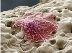 Влияние ударных волн на отложение Ca + + в остеобластах человека in vitro. Влияние ударных волн на отложение Ca + + в остеобластах человека in vitro.