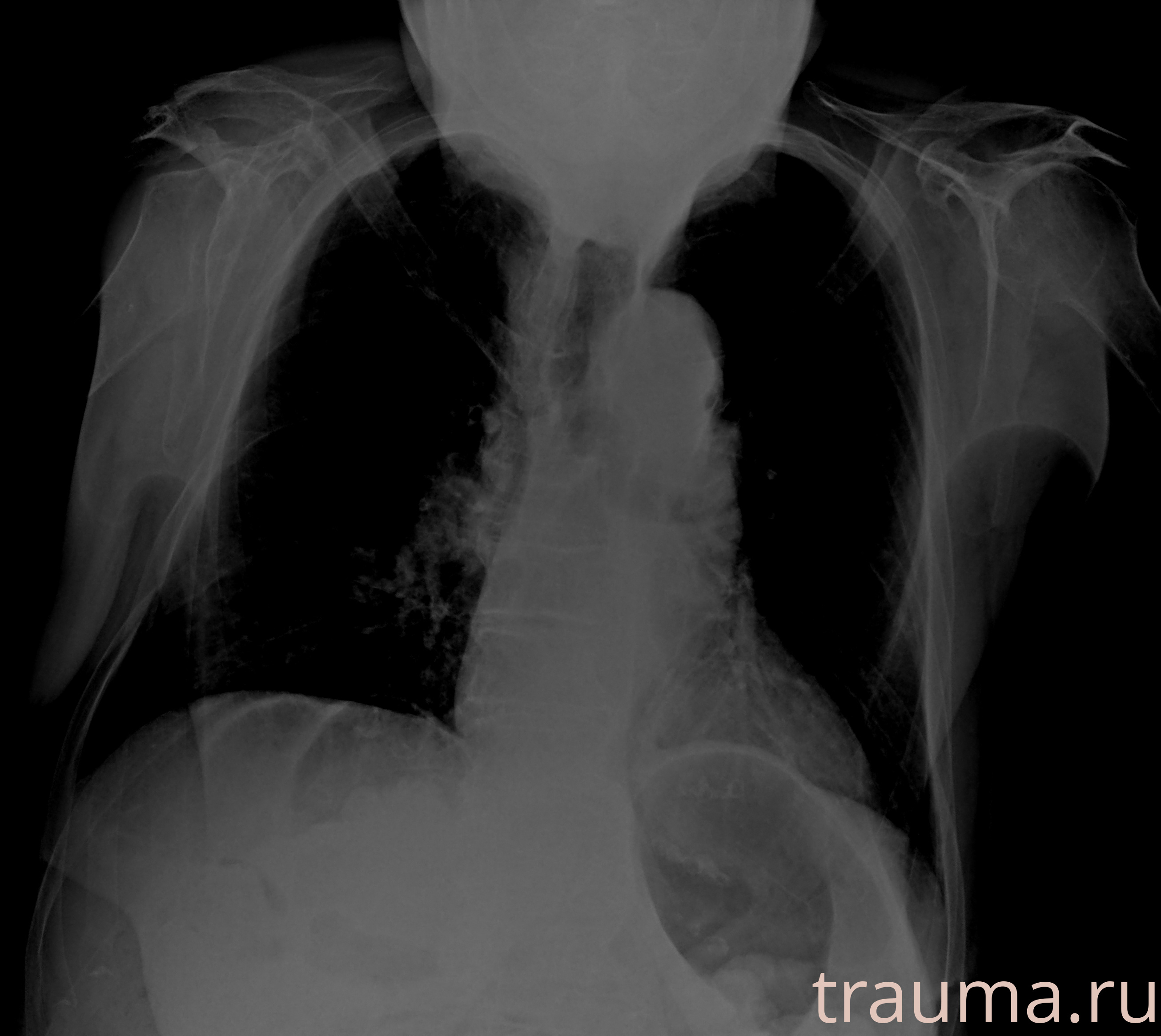 Рентген на дому: по вашему адресу приезжает врач-рентгенолог, травматолог-ортопед с мобильным рентгеновским аппаратом, проводит диагностику травмы или заболевания, делает необходимые рентгенограммы, дает рекомендации по дальнейшему лечению. Получить качественные снимки в домашних условиях возможно благодаря уникальной методике, разработанной МосРентген Центром для института  Склифосовского