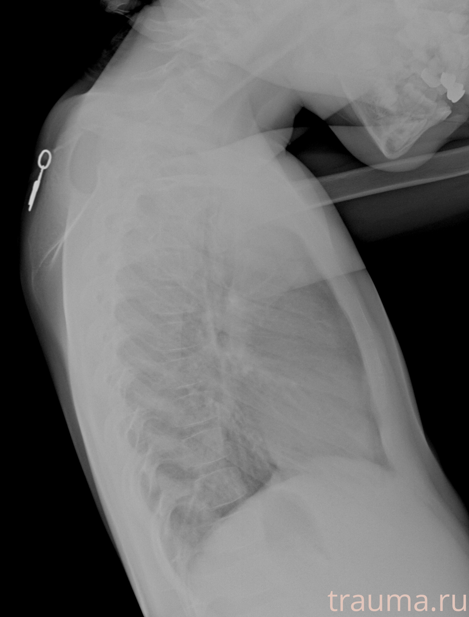 Рентген на дому: по вашему адресу приезжает врач-рентгенолог, травматолог-ортопед с мобильным рентгеновским аппаратом, проводит диагностику травмы или заболевания, делает необходимые рентгенограммы, дает рекомендации по дальнейшему лечению. Получить качественные снимки в домашних условиях возможно благодаря уникальной методике, разработанной МосРентген Центром для института  Склифосовского