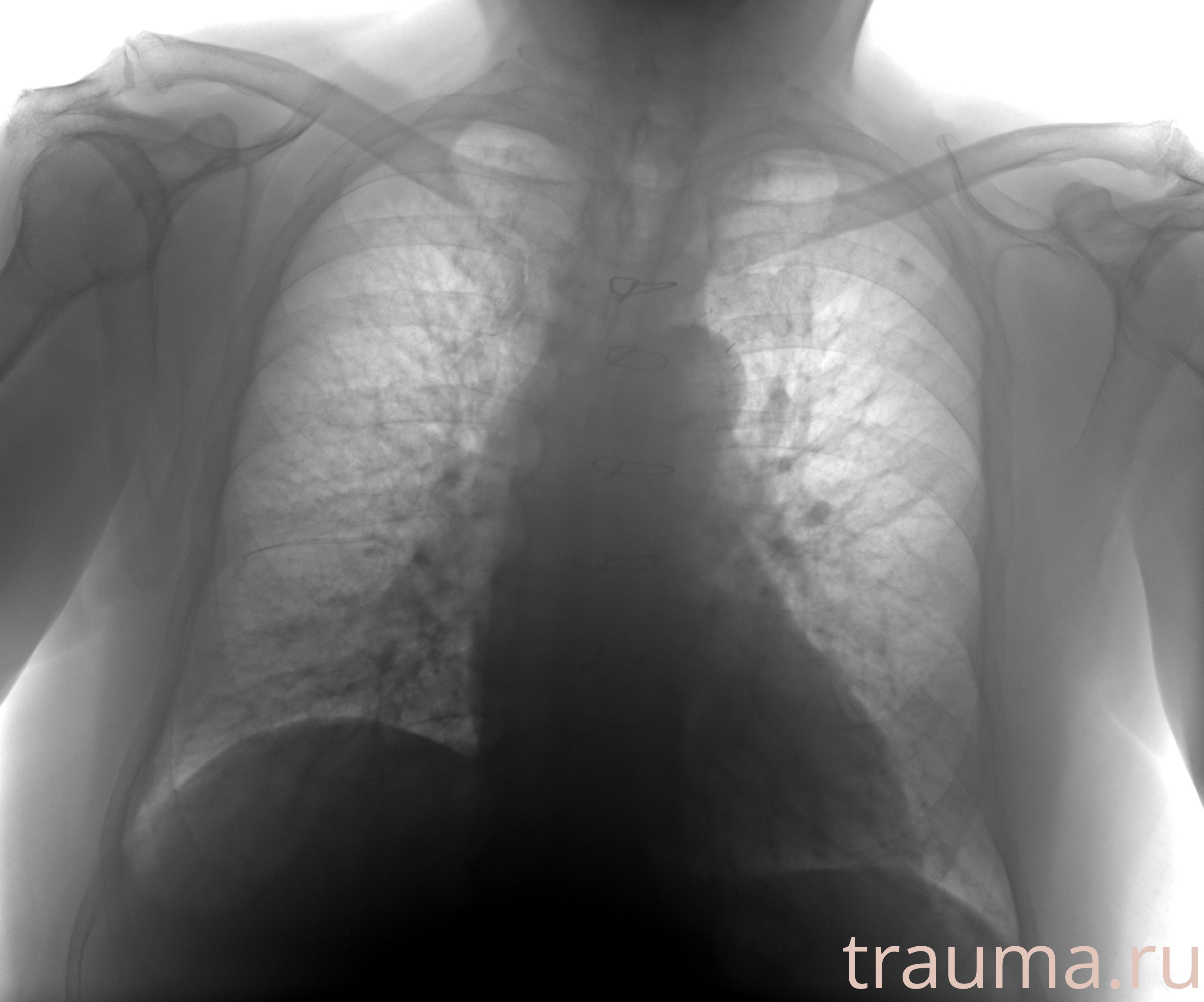 Рентген на дому: по вашему адресу приезжает врач-рентгенолог, травматолог-ортопед с мобильным рентгеновским аппаратом, проводит диагностику травмы или заболевания, делает необходимые рентгенограммы, дает рекомендации по дальнейшему лечению. Получить качественные снимки в домашних условиях возможно благодаря уникальной методике, разработанной МосРентген Центром для института  Склифосовского