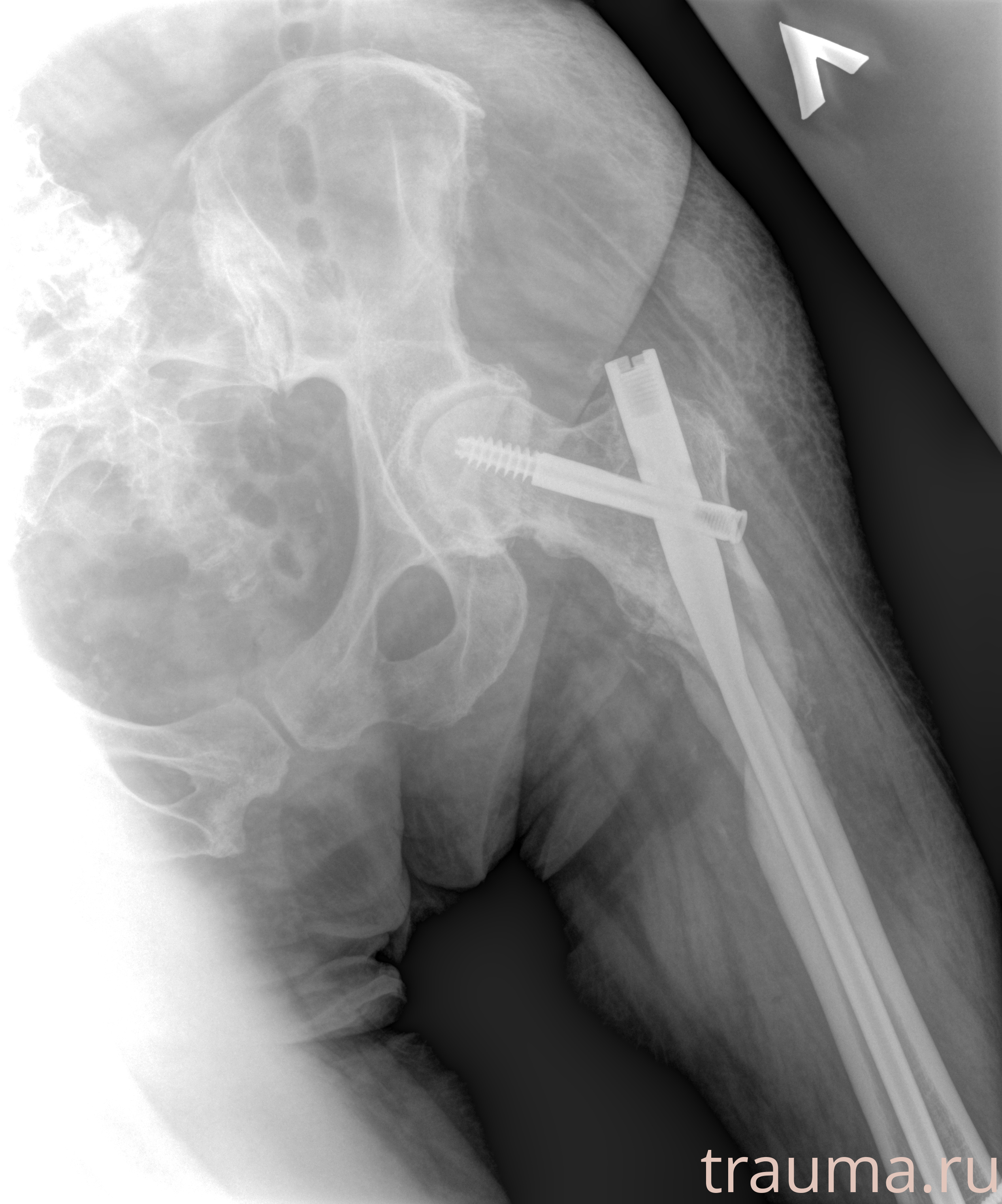 Рентген на дому: по вашему адресу приезжает врач-рентгенолог, травматолог-ортопед с мобильным рентгеновским аппаратом, проводит диагностику травмы или заболевания, делает необходимые рентгенограммы, дает рекомендации по дальнейшему лечению. Получить качественные снимки в домашних условиях возможно благодаря уникальной методике, разработанной МосРентген Центром для института  Склифосовского