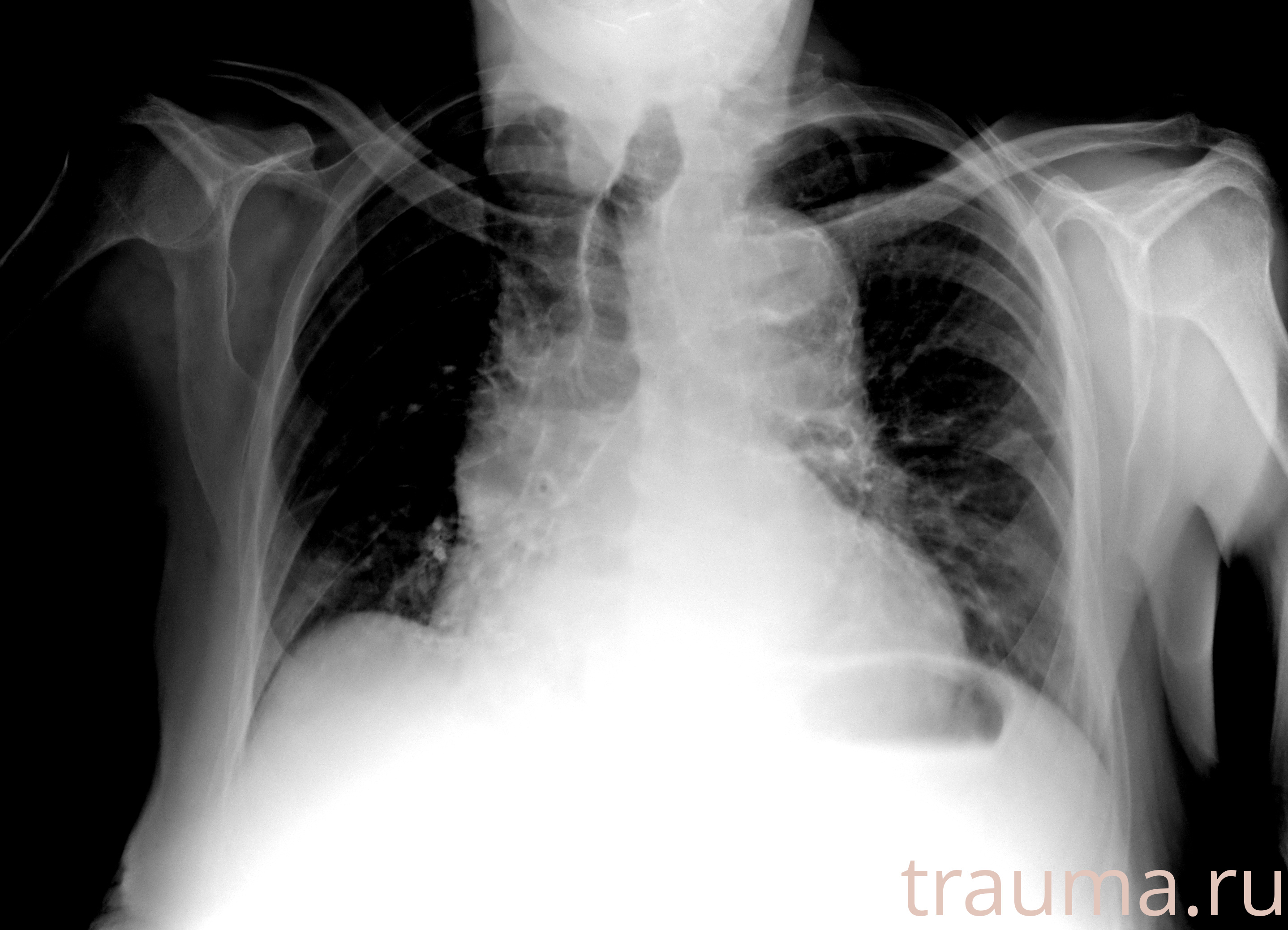 Рентген на дому: по вашему адресу приезжает врач-рентгенолог, травматолог-ортопед с мобильным рентгеновским аппаратом, проводит диагностику травмы или заболевания, делает необходимые рентгенограммы, дает рекомендации по дальнейшему лечению. Получить качественные снимки в домашних условиях возможно благодаря уникальной методике, разработанной МосРентген Центром для института  Склифосовского