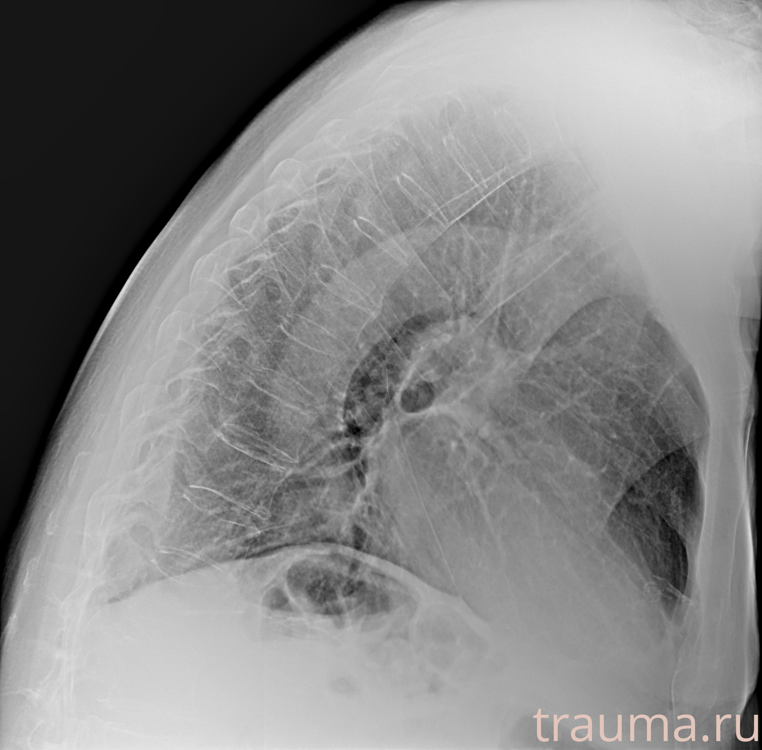 Рентген на дому: по вашему адресу приезжает врач-рентгенолог, травматолог-ортопед с мобильным рентгеновским аппаратом, проводит диагностику травмы или заболевания, делает необходимые рентгенограммы, дает рекомендации по дальнейшему лечению. Получить качественные снимки в домашних условиях возможно благодаря уникальной методике, разработанной МосРентген Центром для института  Склифосовского