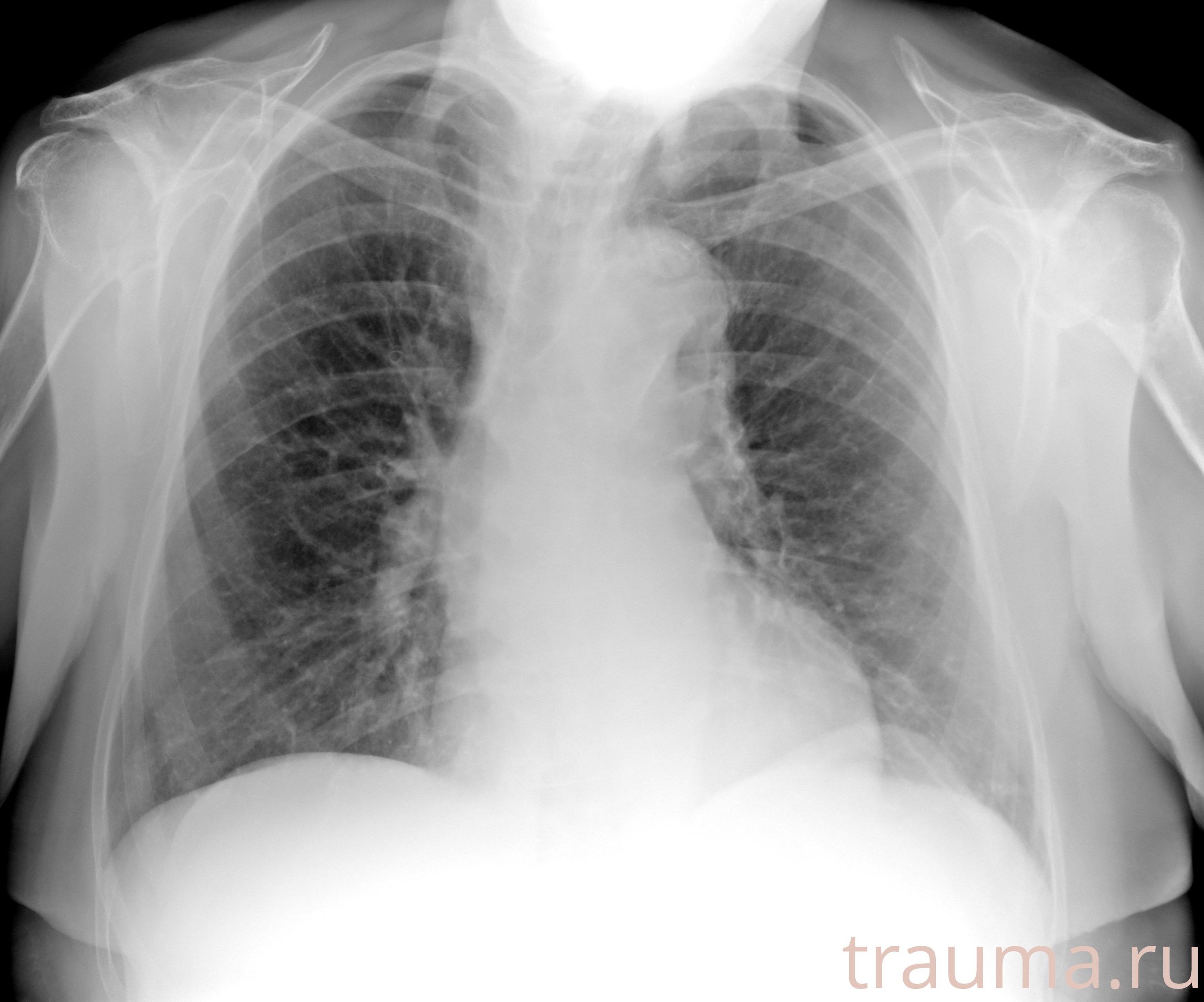 Рентген на дому: по вашему адресу приезжает врач-рентгенолог, травматолог-ортопед с мобильным рентгеновским аппаратом, проводит диагностику травмы или заболевания, делает необходимые рентгенограммы, дает рекомендации по дальнейшему лечению. Получить качественные снимки в домашних условиях возможно благодаря уникальной методике, разработанной МосРентген Центром для института  Склифосовского