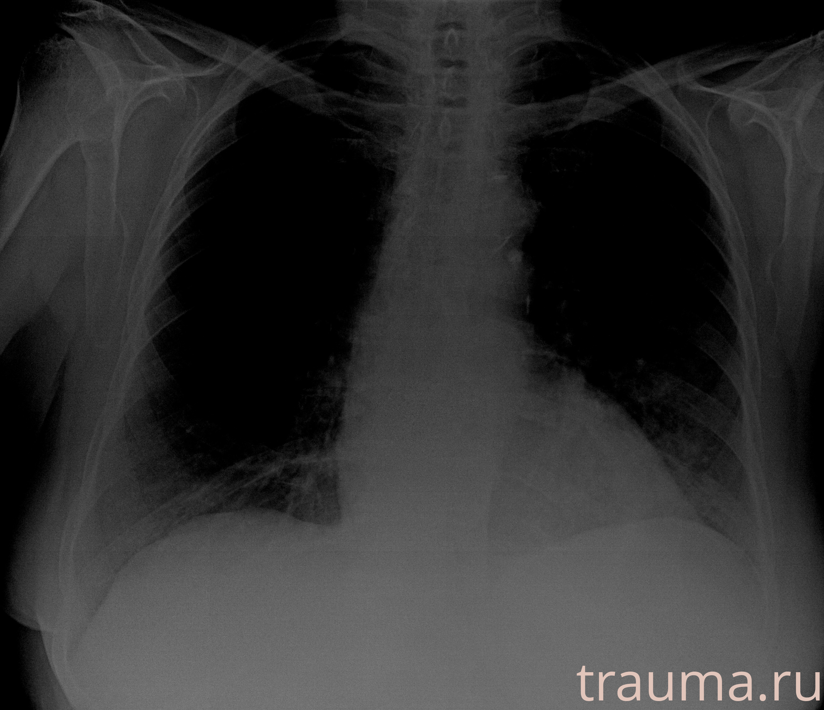 Рентген на дому: по вашему адресу приезжает врач-рентгенолог, травматолог-ортопед с мобильным рентгеновским аппаратом, проводит диагностику травмы или заболевания, делает необходимые рентгенограммы, дает рекомендации по дальнейшему лечению. Получить качественные снимки в домашних условиях возможно благодаря уникальной методике, разработанной МосРентген Центром для института  Склифосовского