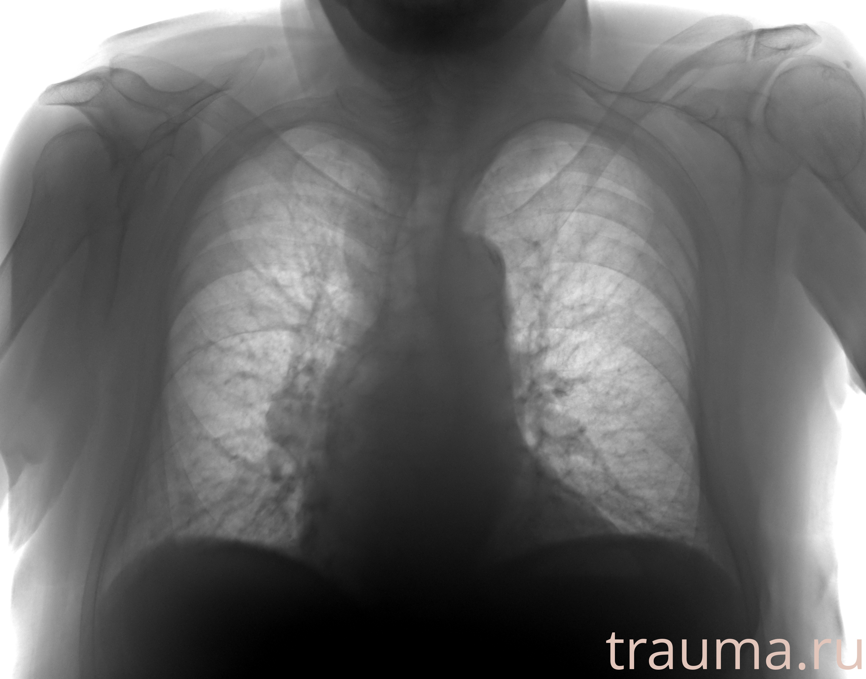 Рентген на дому: по вашему адресу приезжает врач-рентгенолог, травматолог-ортопед с мобильным рентгеновским аппаратом, проводит диагностику травмы или заболевания, делает необходимые рентгенограммы, дает рекомендации по дальнейшему лечению. Получить качественные снимки в домашних условиях возможно благодаря уникальной методике, разработанной МосРентген Центром для института  Склифосовского