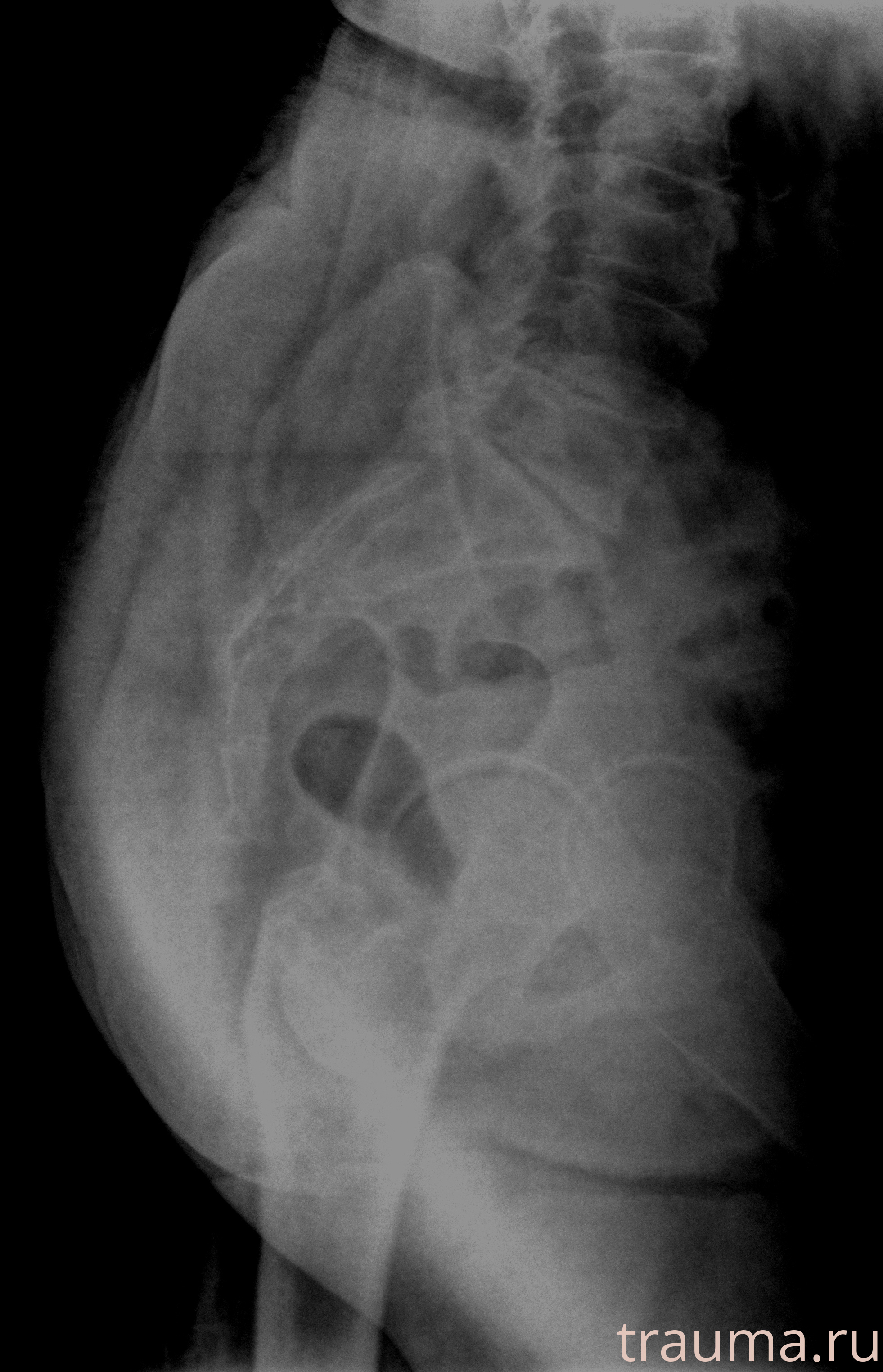 Рентген на дому: по вашему адресу приезжает врач-рентгенолог, травматолог-ортопед с мобильным рентгеновским аппаратом, проводит диагностику травмы или заболевания, делает необходимые рентгенограммы, дает рекомендации по дальнейшему лечению. Получить качественные снимки в домашних условиях возможно благодаря уникальной методике, разработанной МосРентген Центром для института  Склифосовского