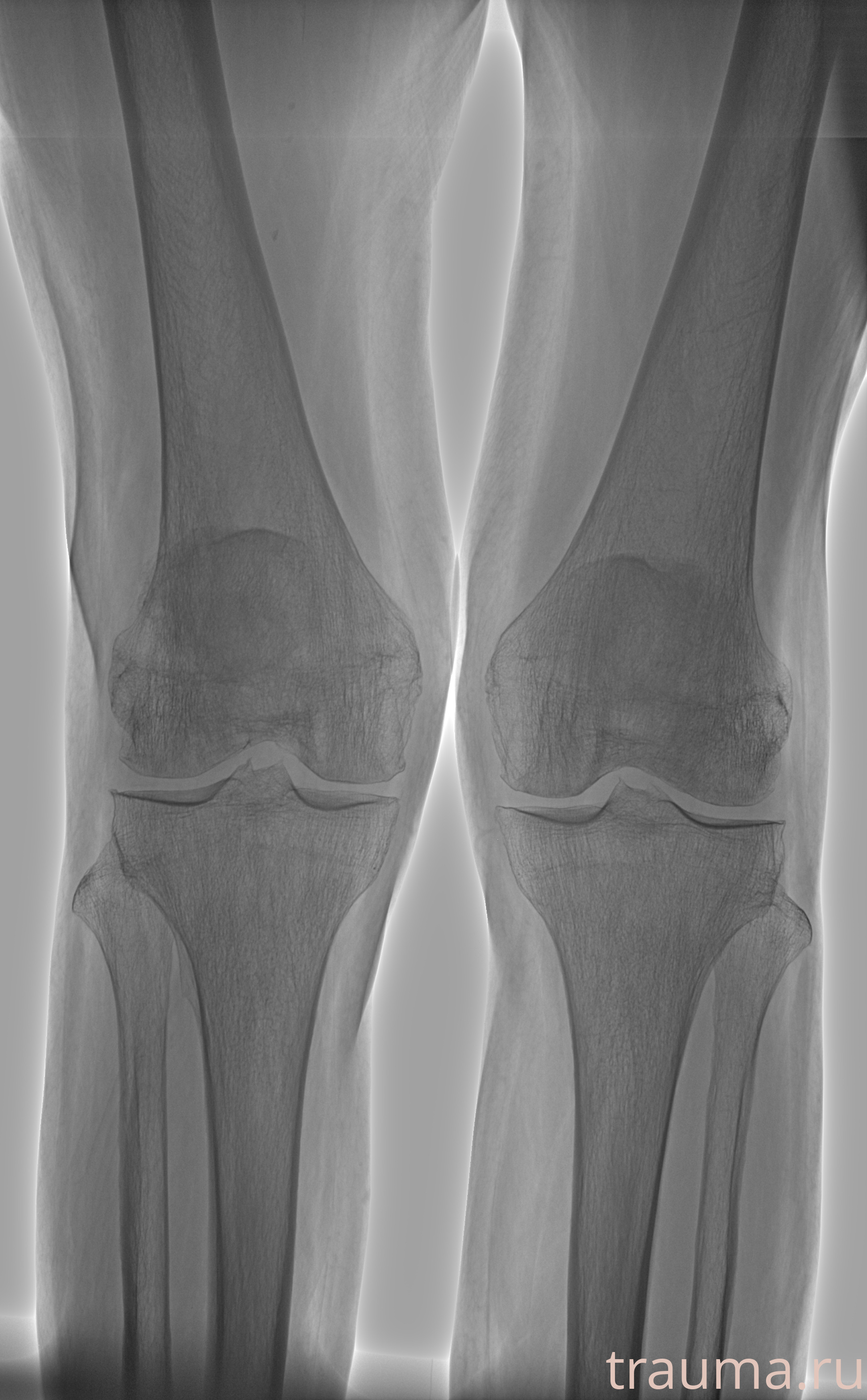 Рентген на дому: по вашему адресу приезжает врач-рентгенолог, травматолог-ортопед с мобильным рентгеновским аппаратом, проводит диагностику травмы или заболевания, делает необходимые рентгенограммы, дает рекомендации по дальнейшему лечению. Получить качественные снимки в домашних условиях возможно благодаря уникальной методике, разработанной МосРентген Центром для института  Склифосовского