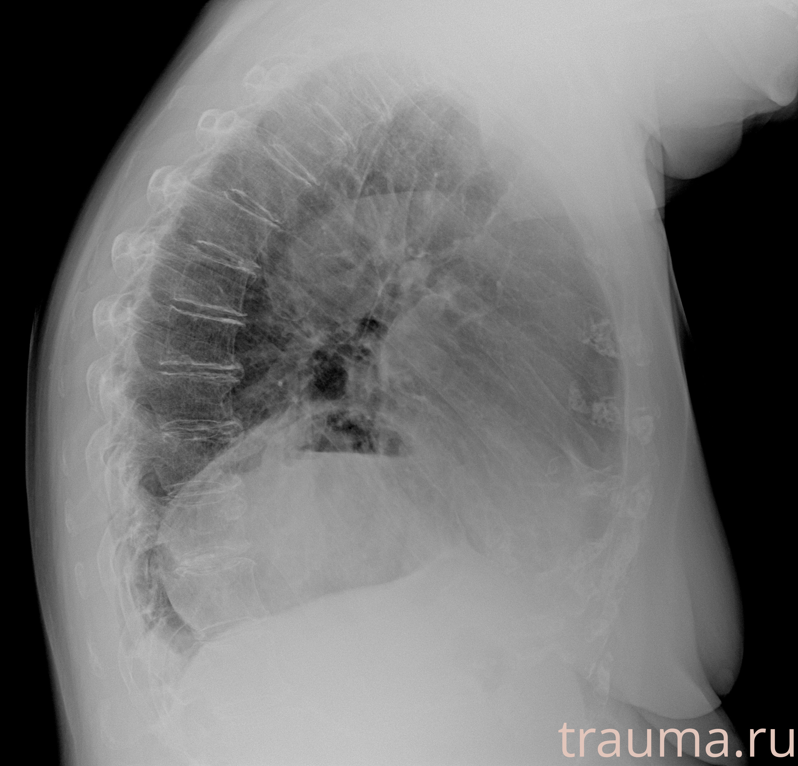 Рентген на дому: по вашему адресу приезжает врач-рентгенолог, травматолог-ортопед с мобильным рентгеновским аппаратом, проводит диагностику травмы или заболевания, делает необходимые рентгенограммы, дает рекомендации по дальнейшему лечению. Получить качественные снимки в домашних условиях возможно благодаря уникальной методике, разработанной МосРентген Центром для института  Склифосовского