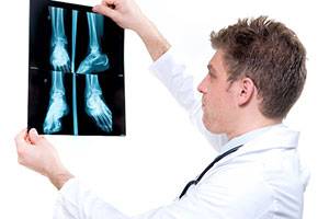 Рентген, осмотр доктором, фиксирующая повязка и мазь от ушибов в Чехии стоят 45 тысяч рублей