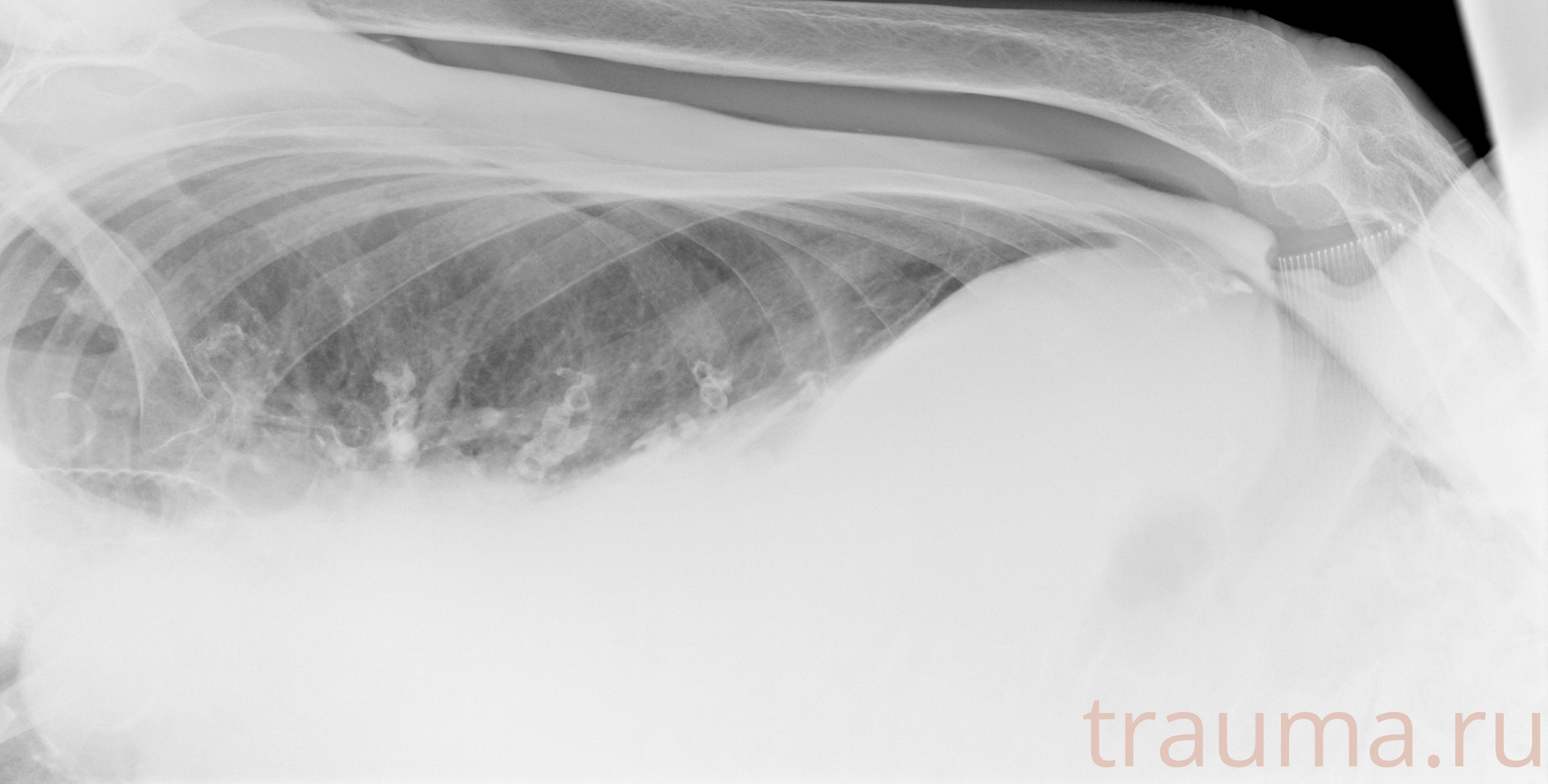 Рентген на дому: по вашему адресу приезжает врач-рентгенолог, травматолог-ортопед с мобильным рентгеновским аппаратом, проводит диагностику травмы или заболевания, делает необходимые рентгенограммы, дает рекомендации по дальнейшему лечению. Получить качественные снимки в домашних условиях возможно благодаря уникальной методике, разработанной МосРентген Центром для института  Склифосовского