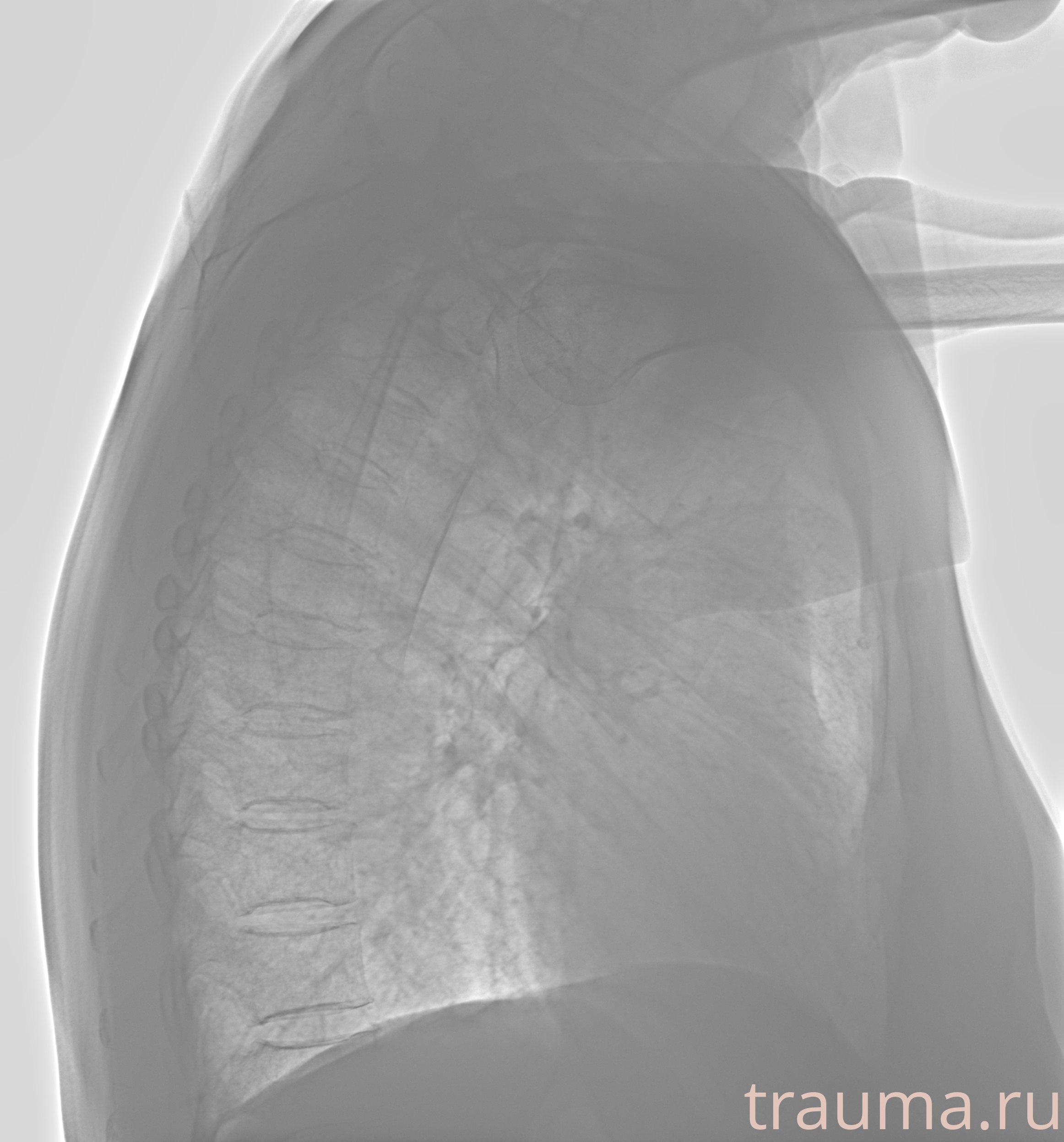 Рентген на дому: по вашему адресу приезжает врач-рентгенолог, травматолог-ортопед с мобильным рентгеновским аппаратом, проводит диагностику травмы или заболевания, делает необходимые рентгенограммы, дает рекомендации по дальнейшему лечению. Получить качественные снимки в домашних условиях возможно благодаря уникальной методике, разработанной МосРентген Центром для института  Склифосовского