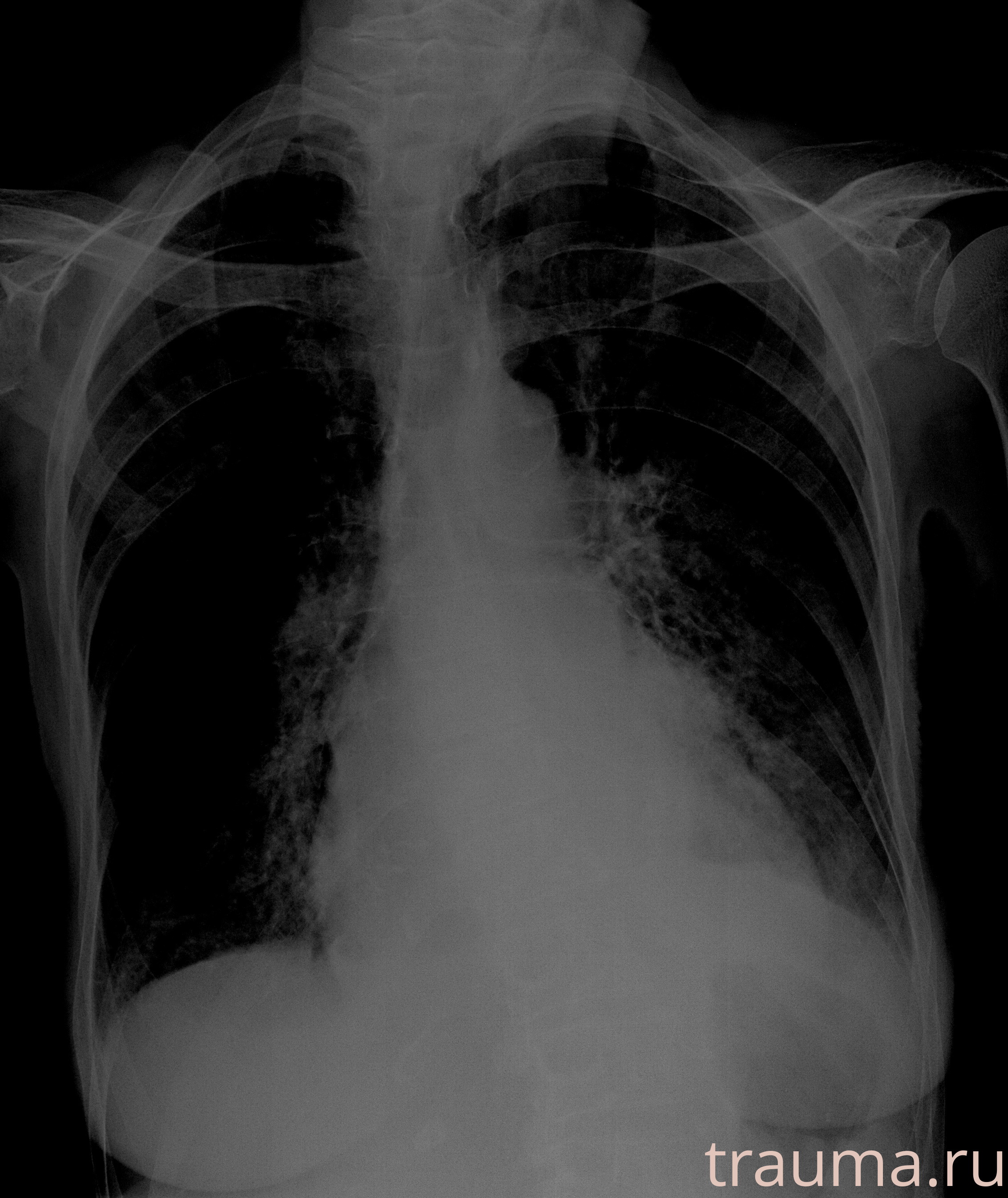 Рентген на дому: по вашему адресу приезжает врач-рентгенолог, травматолог-ортопед с мобильным рентгеновским аппаратом, проводит диагностику травмы или заболевания, делает необходимые рентгенограммы, дает рекомендации по дальнейшему лечению. Получить качественные снимки в домашних условиях возможно благодаря уникальной методике, разработанной МосРентген Центром для института  Склифосовского