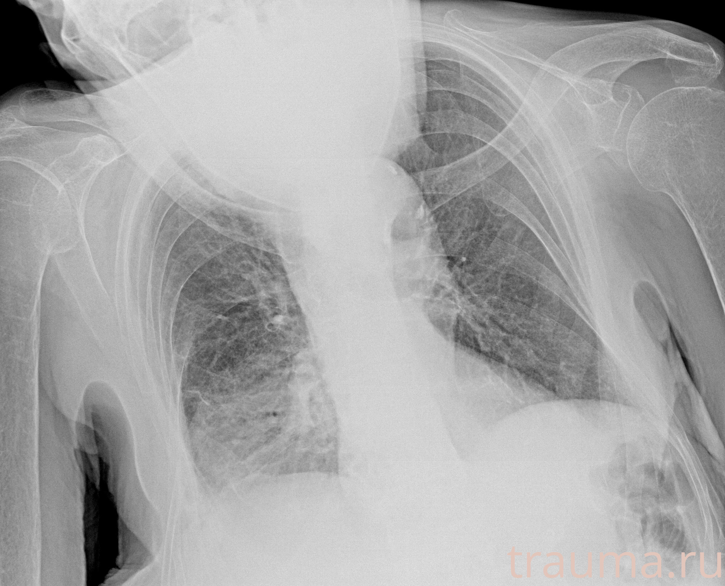 Рентген на дому: по вашему адресу приезжает врач-рентгенолог, травматолог-ортопед с мобильным рентгеновским аппаратом, проводит диагностику травмы или заболевания, делает необходимые рентгенограммы, дает рекомендации по дальнейшему лечению. Получить качественные снимки в домашних условиях возможно благодаря уникальной методике, разработанной МосРентген Центром для института  Склифосовского