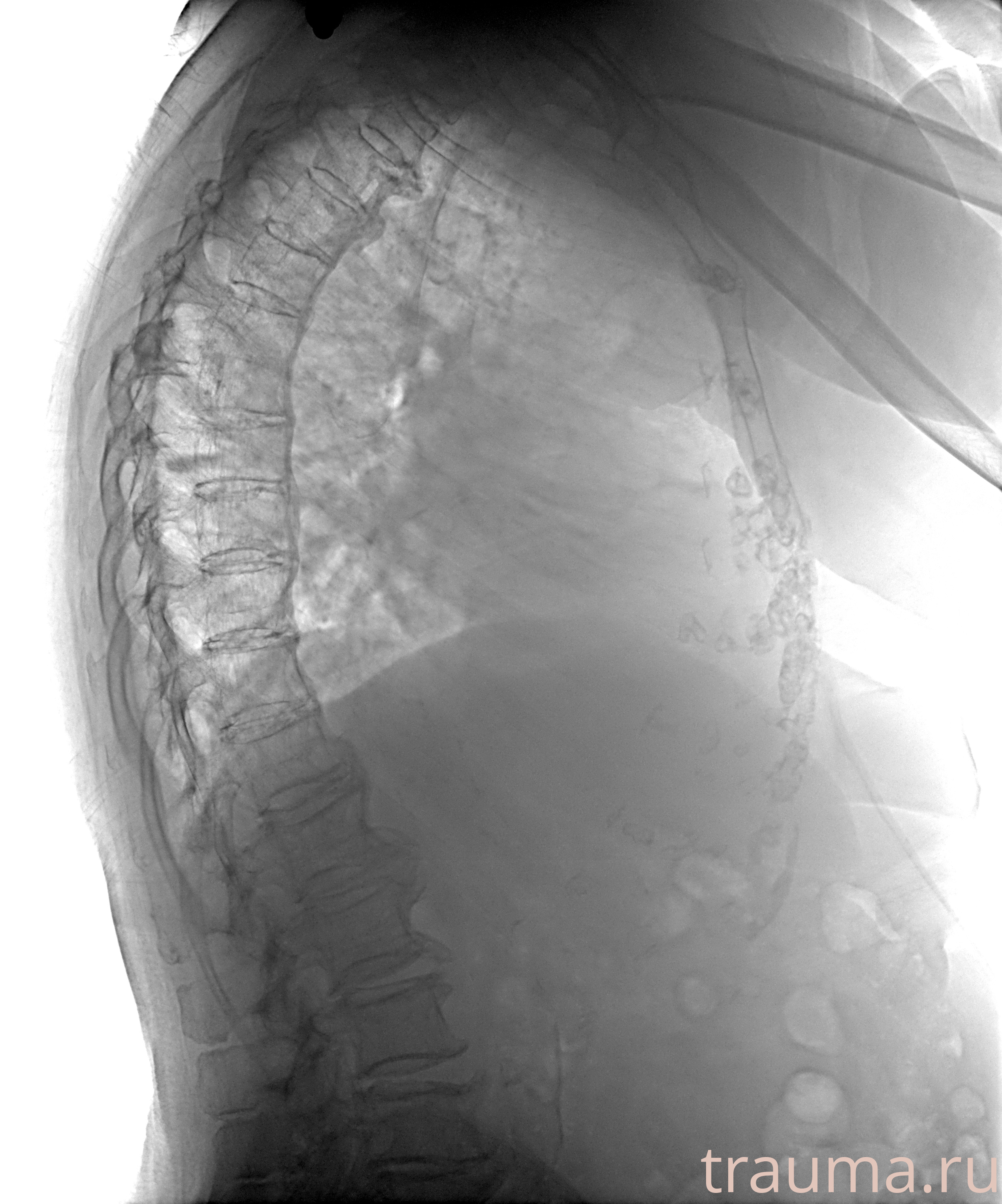 Рентген на дому: по вашему адресу приезжает врач-рентгенолог, травматолог-ортопед с мобильным рентгеновским аппаратом, проводит диагностику травмы или заболевания, делает необходимые рентгенограммы, дает рекомендации по дальнейшему лечению. Получить качественные снимки в домашних условиях возможно благодаря уникальной методике, разработанной МосРентген Центром для института  Склифосовского