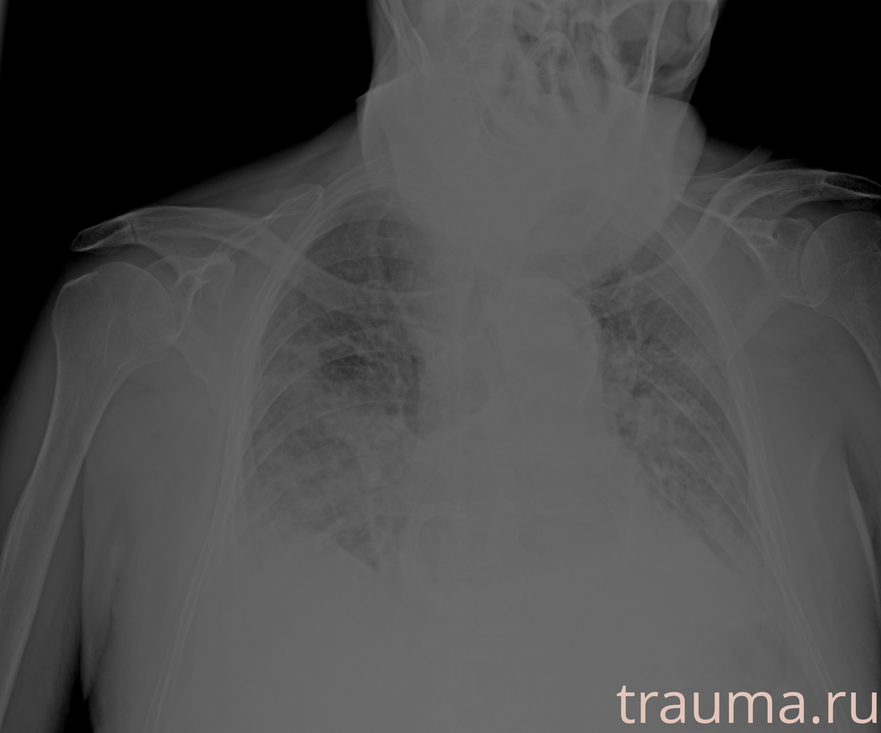 Рентген на дому: по вашему адресу приезжает врач-рентгенолог, травматолог-ортопед с мобильным рентгеновским аппаратом, проводит диагностику травмы или заболевания, делает необходимые рентгенограммы, дает рекомендации по дальнейшему лечению. Получить качественные снимки в домашних условиях возможно благодаря уникальной методике, разработанной МосРентген Центром для института  Склифосовского