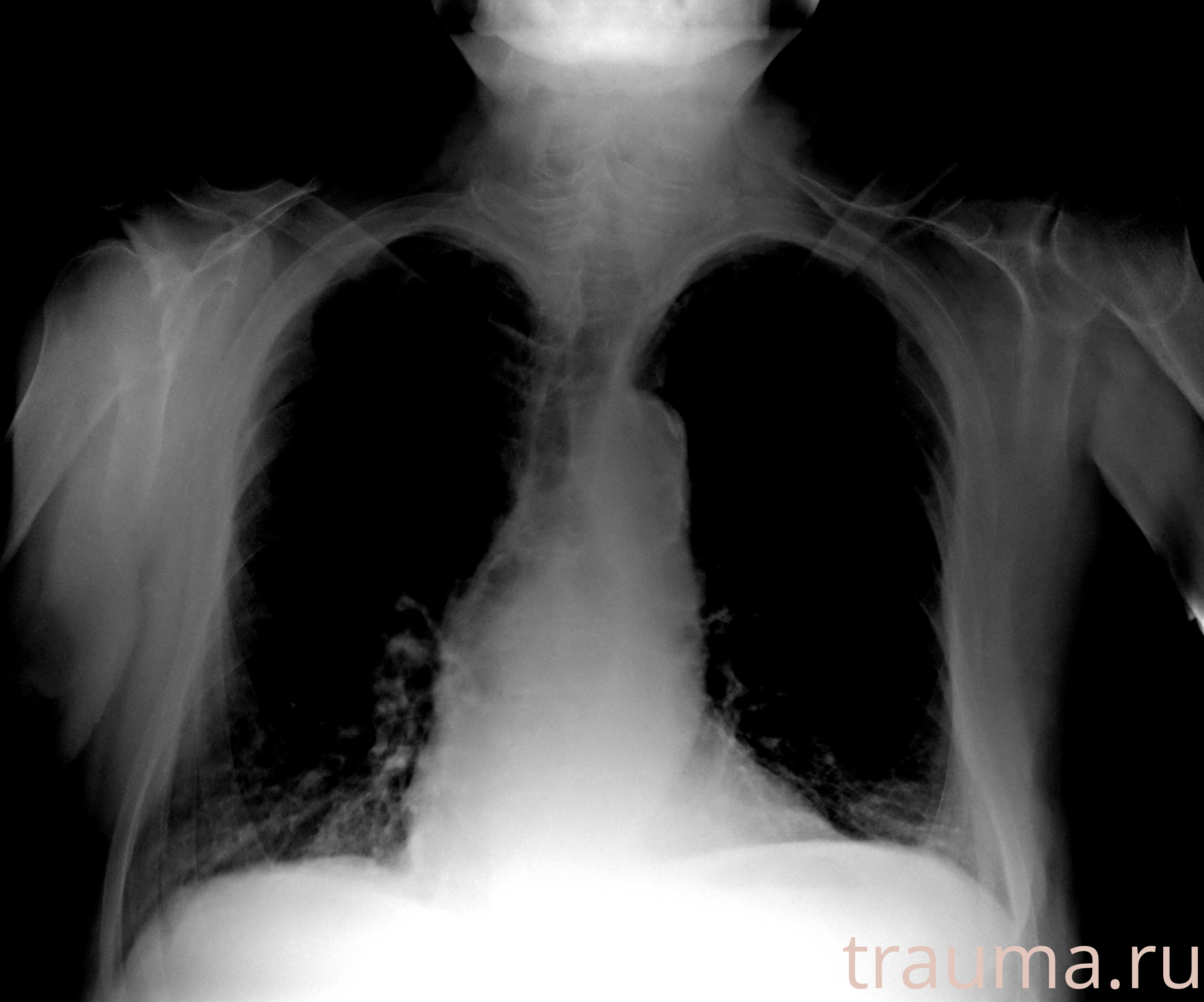 Рентген на дому: по вашему адресу приезжает врач-рентгенолог, травматолог-ортопед с мобильным рентгеновским аппаратом, проводит диагностику травмы или заболевания, делает необходимые рентгенограммы, дает рекомендации по дальнейшему лечению. Получить качественные снимки в домашних условиях возможно благодаря уникальной методике, разработанной МосРентген Центром для института  Склифосовского