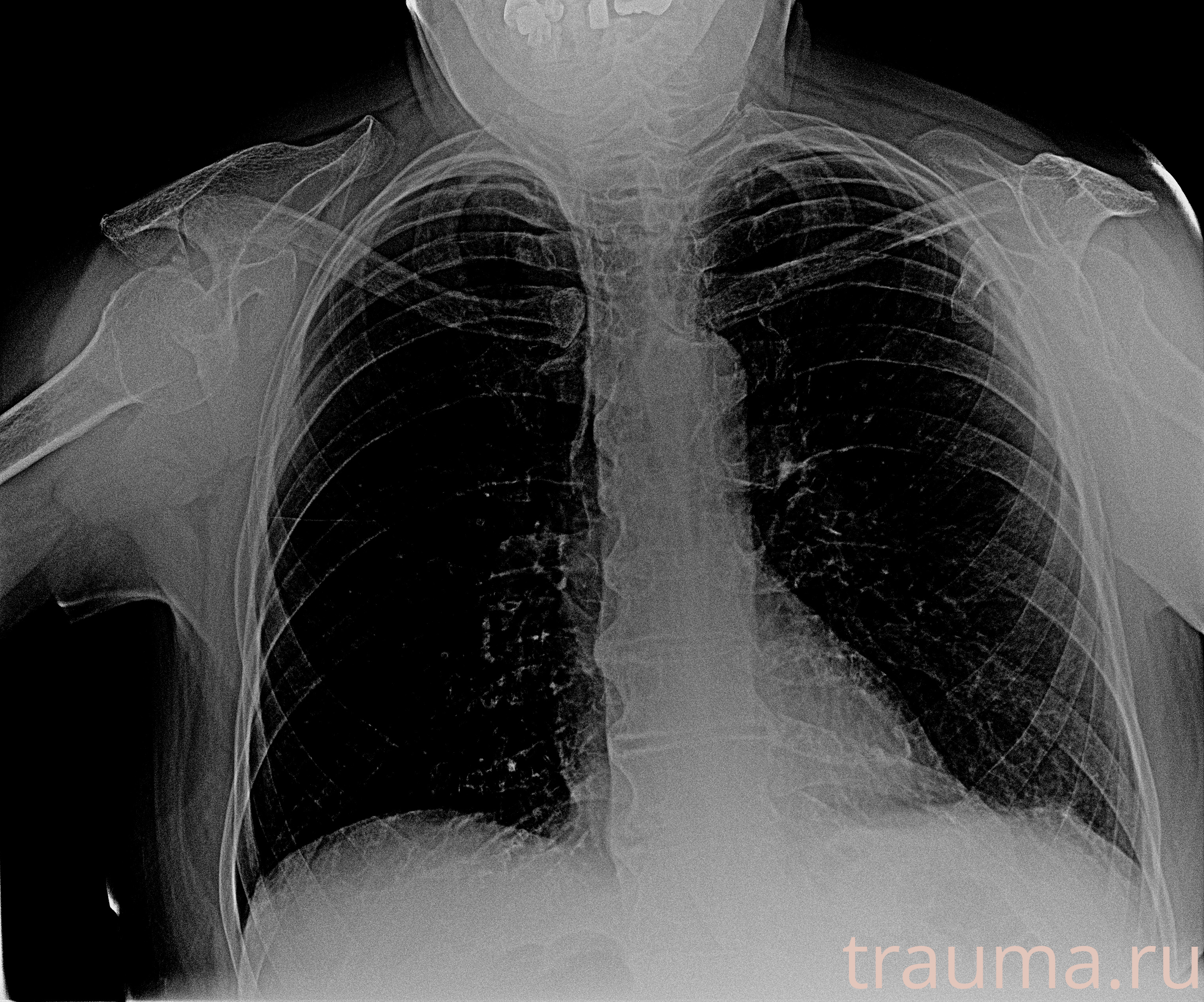 Рентген на дому: по вашему адресу приезжает врач-рентгенолог, травматолог-ортопед с мобильным рентгеновским аппаратом, проводит диагностику травмы или заболевания, делает необходимые рентгенограммы, дает рекомендации по дальнейшему лечению. Получить качественные снимки в домашних условиях возможно благодаря уникальной методике, разработанной МосРентген Центром для института  Склифосовского