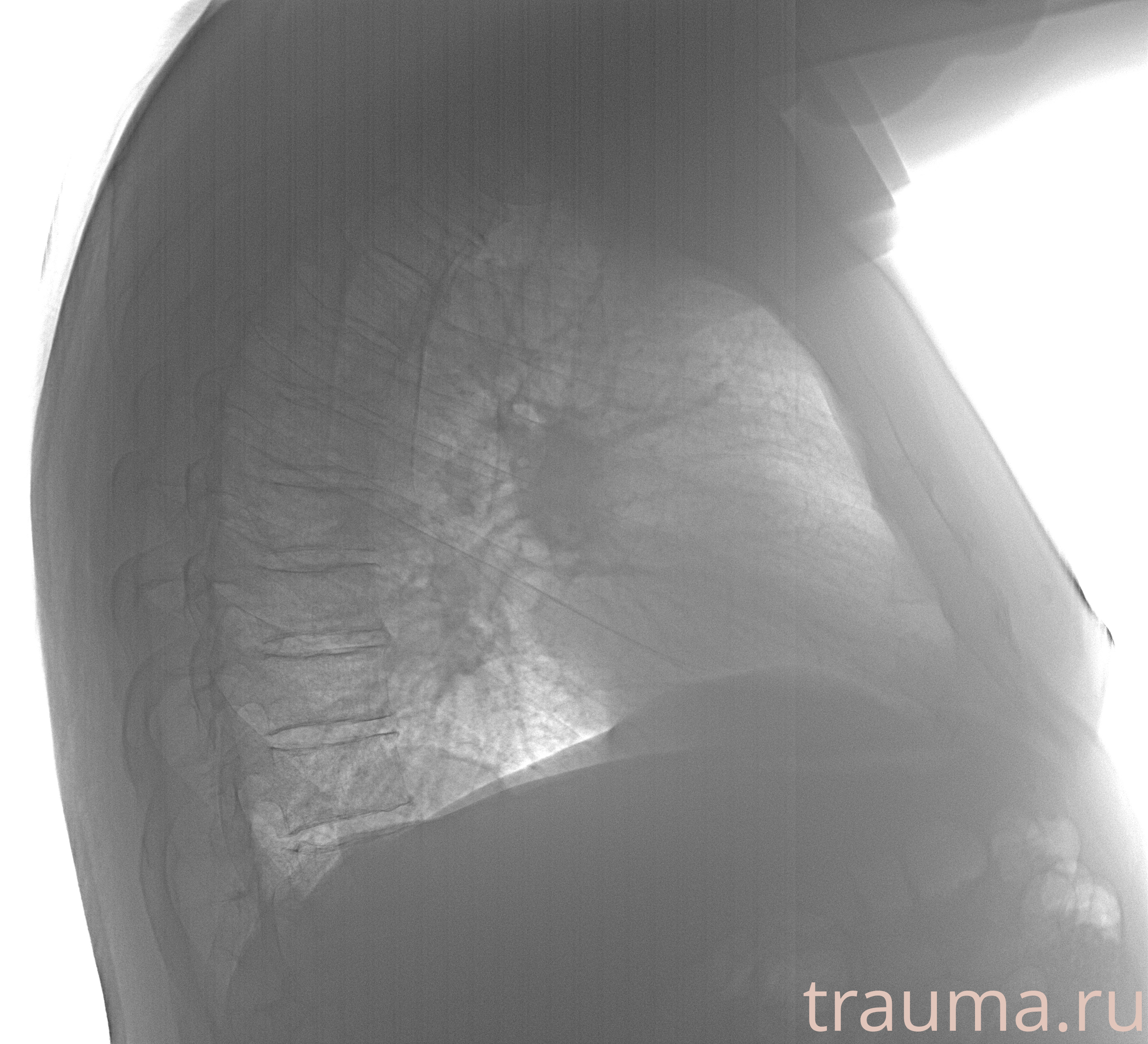 Рентген на дому: по вашему адресу приезжает врач-рентгенолог, травматолог-ортопед с мобильным рентгеновским аппаратом, проводит диагностику травмы или заболевания, делает необходимые рентгенограммы, дает рекомендации по дальнейшему лечению. Получить качественные снимки в домашних условиях возможно благодаря уникальной методике, разработанной МосРентген Центром для института  Склифосовского