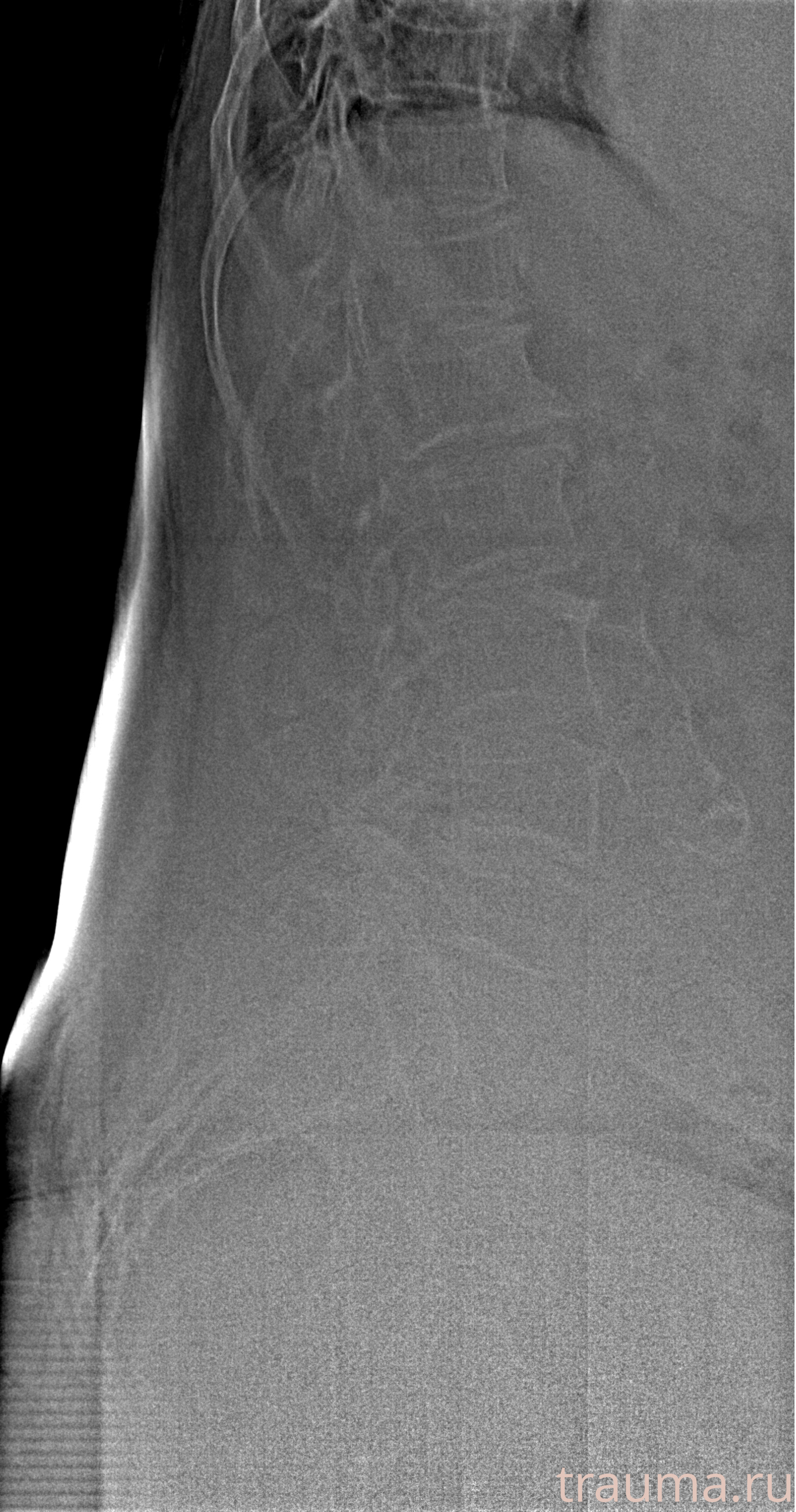 Рентген на дому: по вашему адресу приезжает врач-рентгенолог, травматолог-ортопед с мобильным рентгеновским аппаратом, проводит диагностику травмы или заболевания, делает необходимые рентгенограммы, дает рекомендации по дальнейшему лечению. Получить качественные снимки в домашних условиях возможно благодаря уникальной методике, разработанной МосРентген Центром для института  Склифосовского