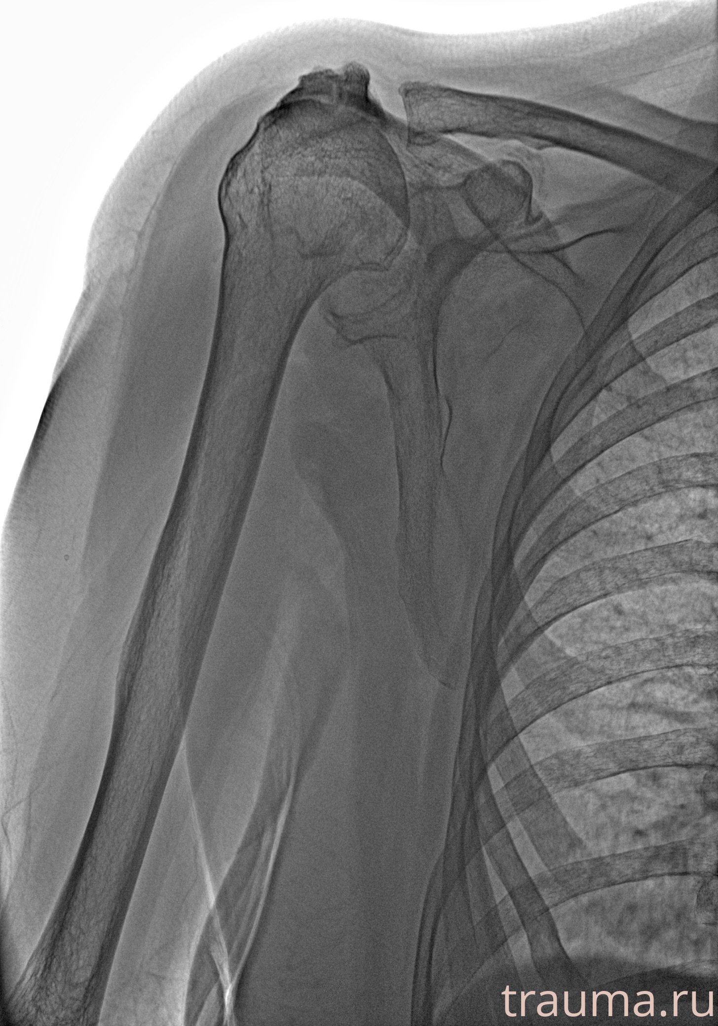 Рентген на дому: по вашему адресу приезжает врач-рентгенолог, травматолог-ортопед с мобильным рентгеновским аппаратом, проводит диагностику травмы или заболевания, делает необходимые рентгенограммы, дает рекомендации по дальнейшему лечению. Получить качественные снимки в домашних условиях возможно благодаря уникальной методике, разработанной МосРентген Центром для института  Склифосовского