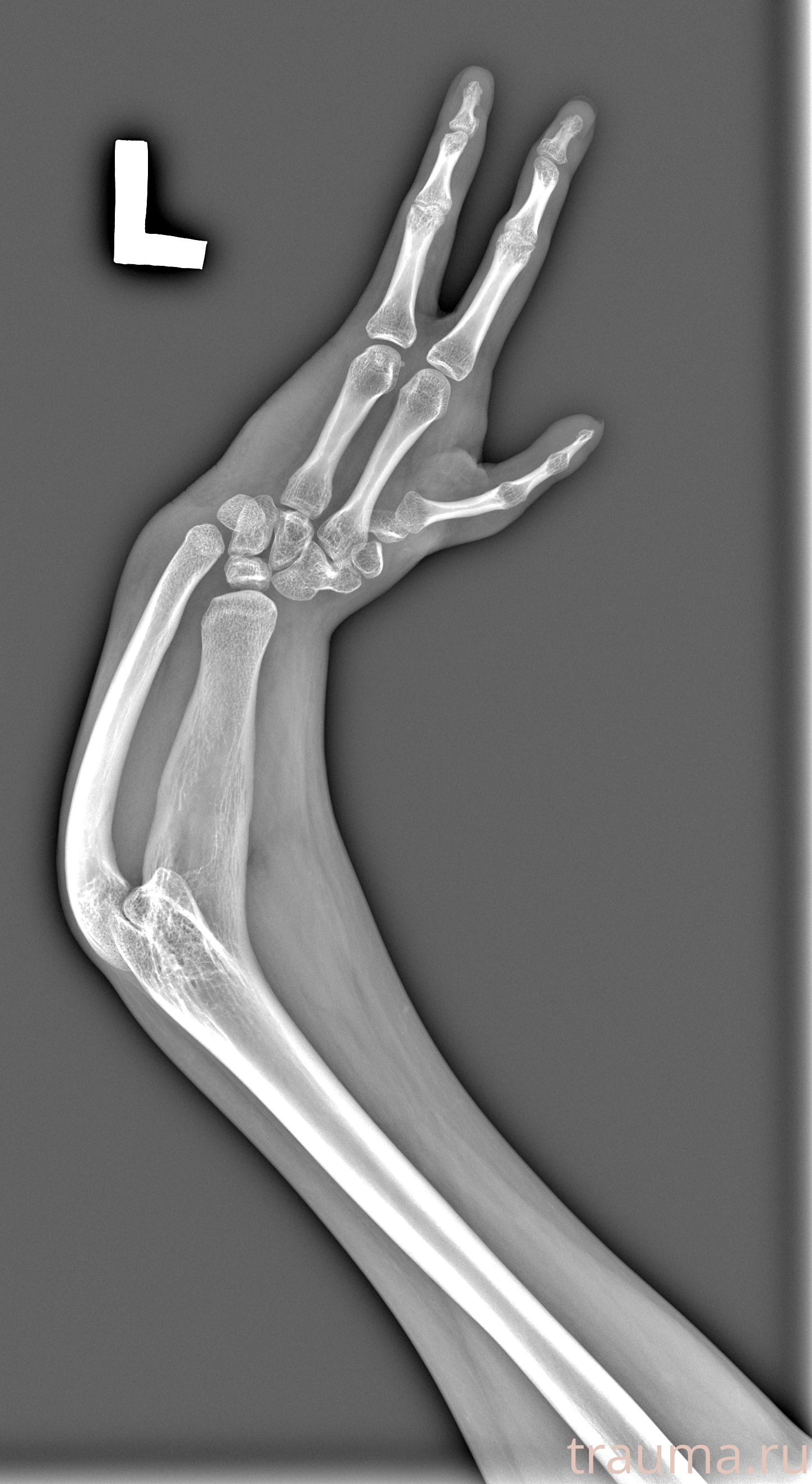 Рентген на дому: по вашему адресу приезжает врач-рентгенолог, травматолог-ортопед с мобильным рентгеновским аппаратом, проводит диагностику травмы или заболевания, делает необходимые рентгенограммы, дает рекомендации по дальнейшему лечению. Получить качественные снимки в домашних условиях возможно благодаря уникальной методике, разработанной МосРентген Центром для института  Склифосовского