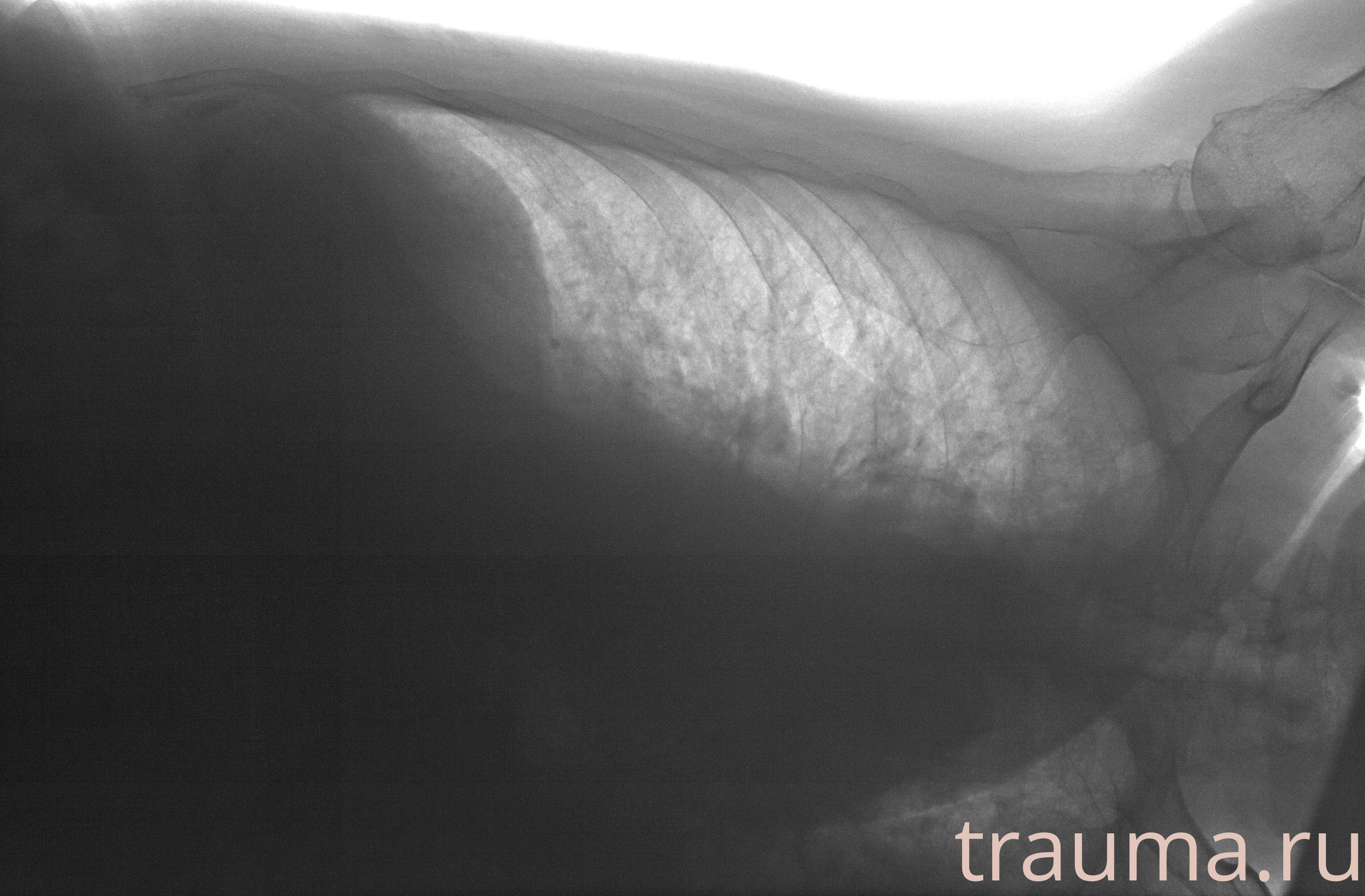 Рентген на дому: по вашему адресу приезжает врач-рентгенолог, травматолог-ортопед с мобильным рентгеновским аппаратом, проводит диагностику травмы или заболевания, делает необходимые рентгенограммы, дает рекомендации по дальнейшему лечению. Получить качественные снимки в домашних условиях возможно благодаря уникальной методике, разработанной МосРентген Центром для института  Склифосовского