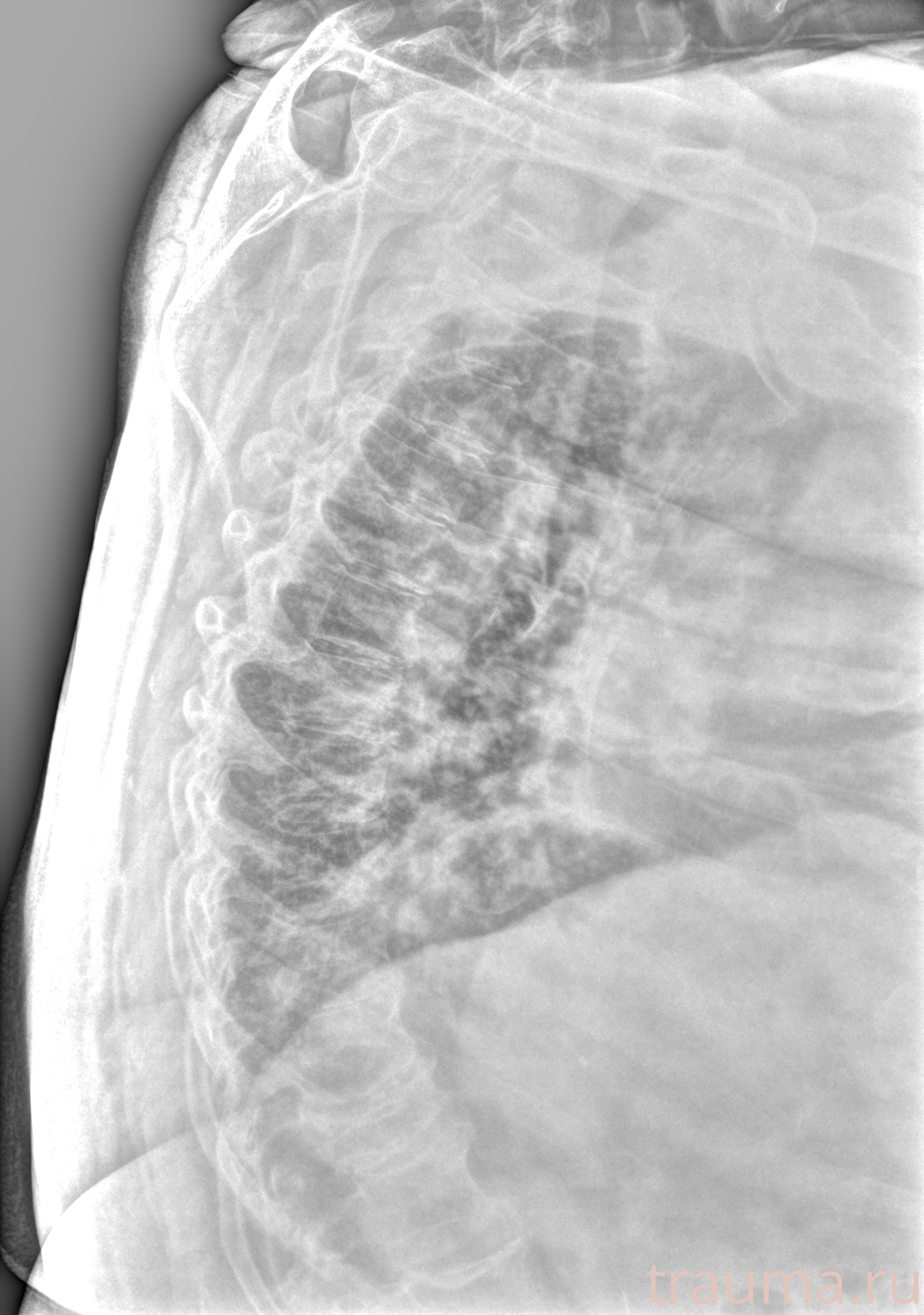 Рентген на дому: по вашему адресу приезжает врач-рентгенолог, травматолог-ортопед с мобильным рентгеновским аппаратом, проводит диагностику травмы или заболевания, делает необходимые рентгенограммы, дает рекомендации по дальнейшему лечению. Получить качественные снимки в домашних условиях возможно благодаря уникальной методике, разработанной МосРентген Центром для института  Склифосовского