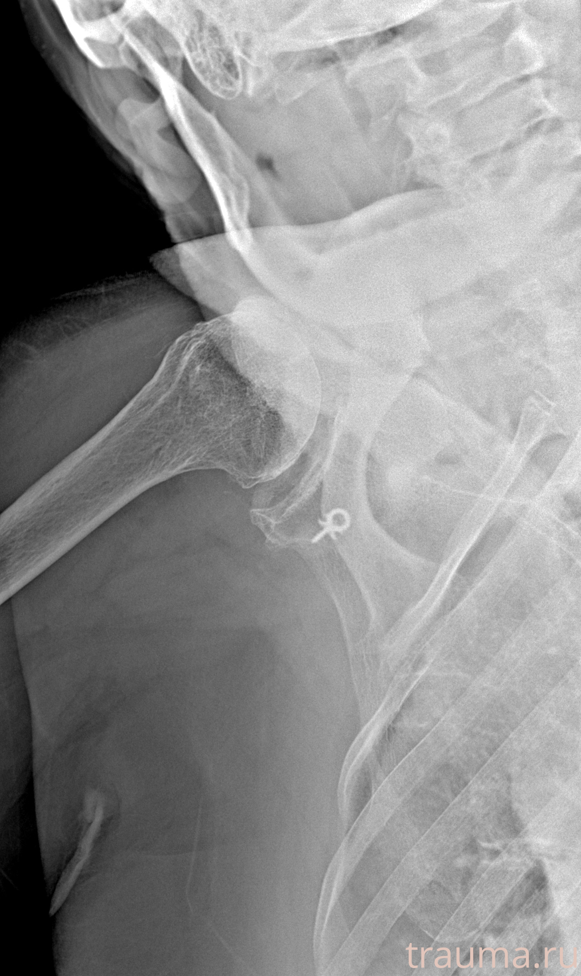 Рентген на дому: по вашему адресу приезжает врач-рентгенолог, травматолог-ортопед с мобильным рентгеновским аппаратом, проводит диагностику травмы или заболевания, делает необходимые рентгенограммы, дает рекомендации по дальнейшему лечению. Получить качественные снимки в домашних условиях возможно благодаря уникальной методике, разработанной МосРентген Центром для института  Склифосовского