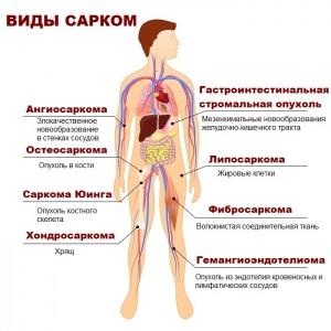 Практические рекомендации по лекарственному лечению сарком мягких тканей Практические рекомендации по лекарственному лечению сарком мягких тканей