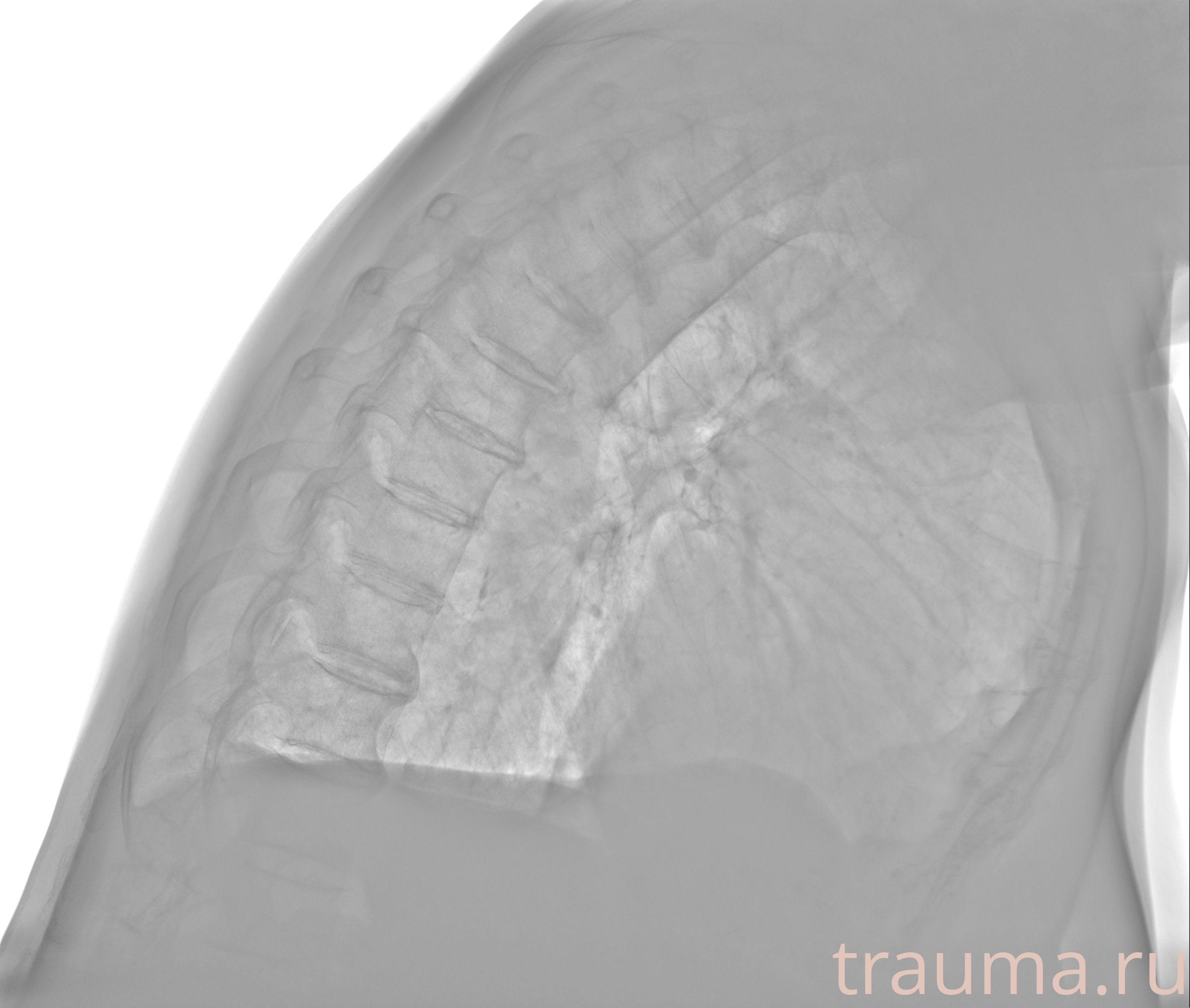 Рентген на дому: по вашему адресу приезжает врач-рентгенолог, травматолог-ортопед с мобильным рентгеновским аппаратом, проводит диагностику травмы или заболевания, делает необходимые рентгенограммы, дает рекомендации по дальнейшему лечению. Получить качественные снимки в домашних условиях возможно благодаря уникальной методике, разработанной МосРентген Центром для института  Склифосовского