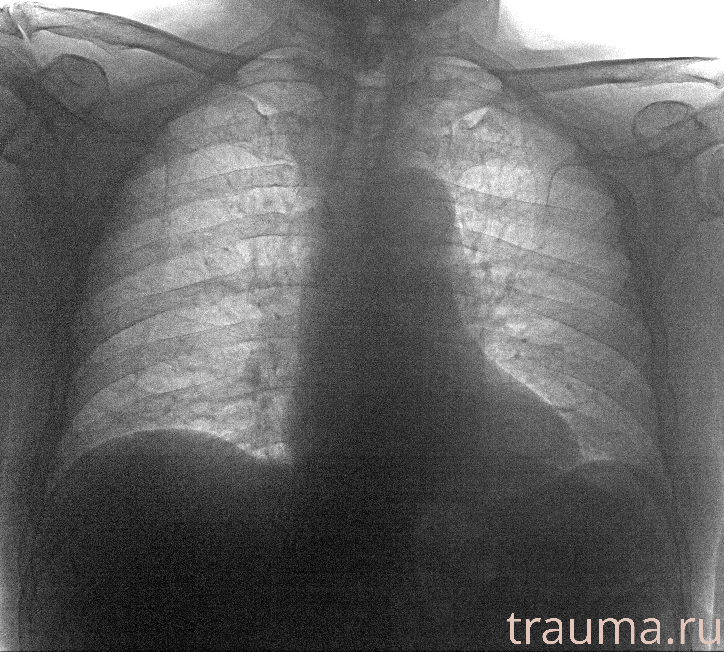 Рентген на дому: по вашему адресу приезжает врач-рентгенолог, травматолог-ортопед с мобильным рентгеновским аппаратом, проводит диагностику травмы или заболевания, делает необходимые рентгенограммы, дает рекомендации по дальнейшему лечению. Получить качественные снимки в домашних условиях возможно благодаря уникальной методике, разработанной МосРентген Центром для института  Склифосовского