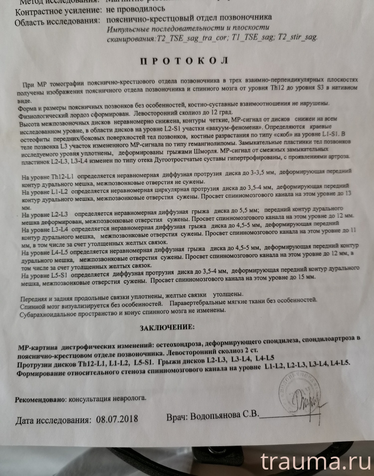 Рентген на дому: по вашему адресу приезжает врач-рентгенолог, травматолог-ортопед с мобильным рентгеновским аппаратом, проводит диагностику травмы или заболевания, делает необходимые рентгенограммы, дает рекомендации по дальнейшему лечению. Получить качественные снимки в домашних условиях возможно благодаря уникальной методике, разработанной МосРентген Центром для института  Склифосовского
