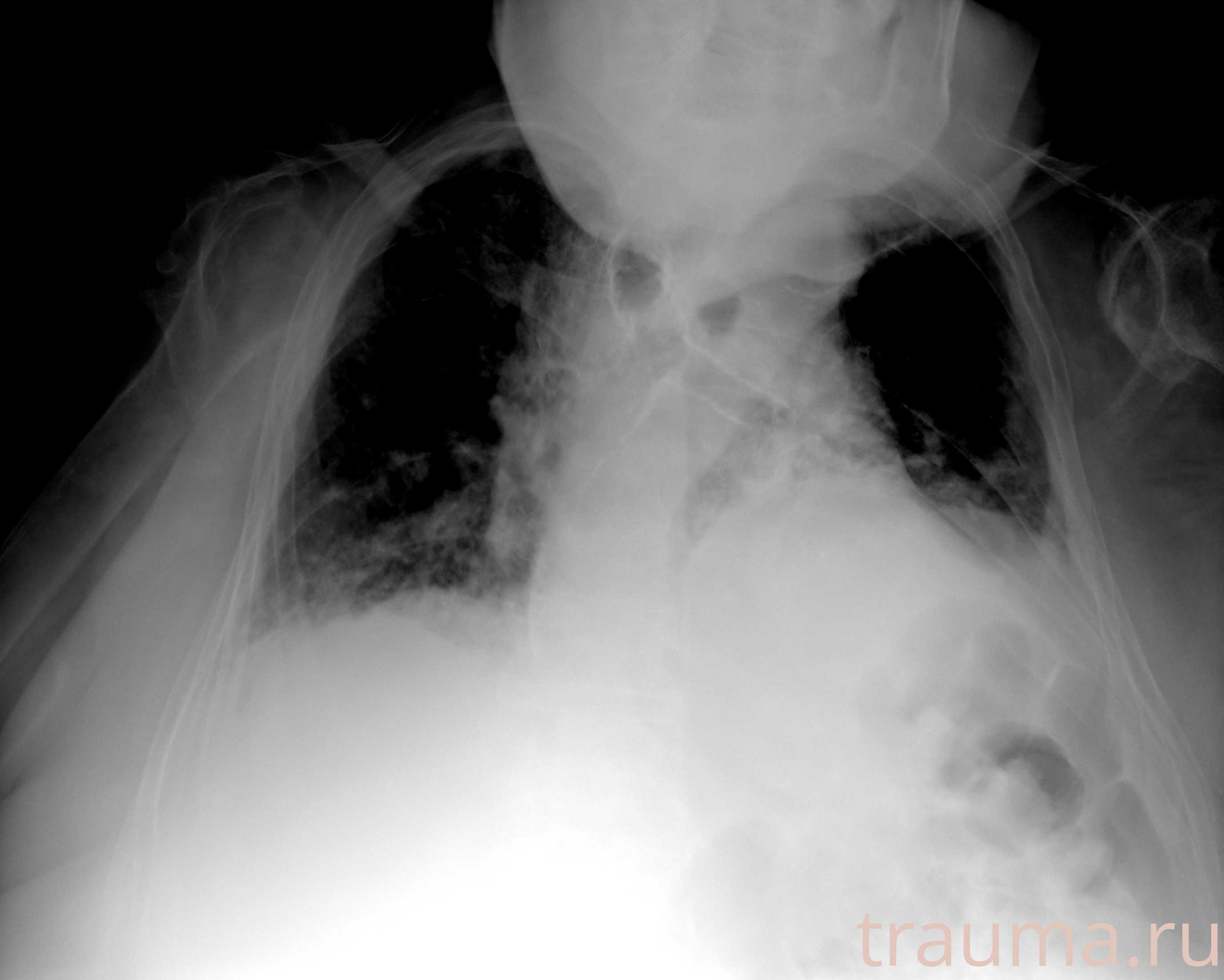 Рентген на дому: по вашему адресу приезжает врач-рентгенолог, травматолог-ортопед с мобильным рентгеновским аппаратом, проводит диагностику травмы или заболевания, делает необходимые рентгенограммы, дает рекомендации по дальнейшему лечению. Получить качественные снимки в домашних условиях возможно благодаря уникальной методике, разработанной МосРентген Центром для института  Склифосовского