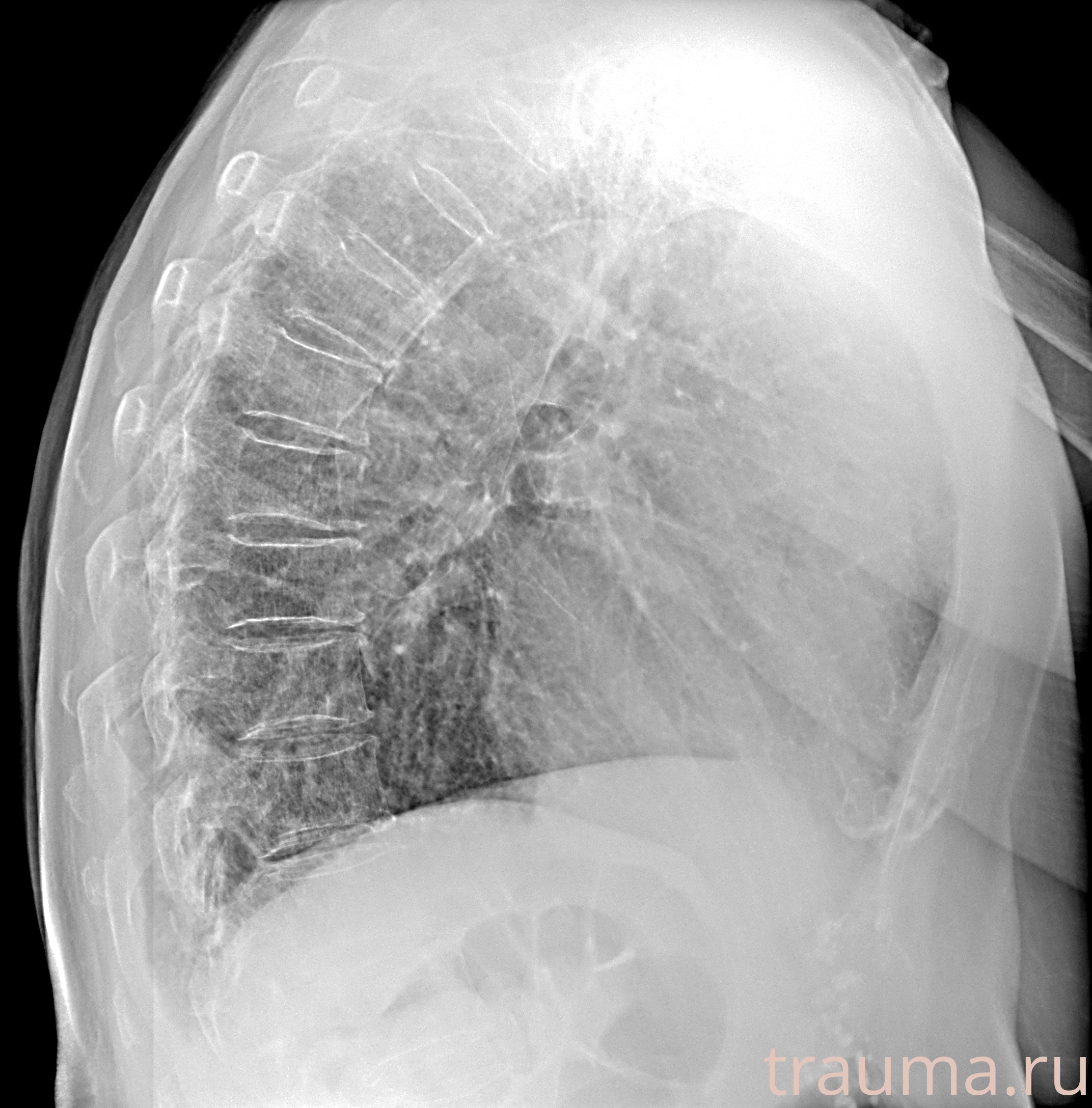 Рентген на дому: по вашему адресу приезжает врач-рентгенолог, травматолог-ортопед с мобильным рентгеновским аппаратом, проводит диагностику травмы или заболевания, делает необходимые рентгенограммы, дает рекомендации по дальнейшему лечению. Получить качественные снимки в домашних условиях возможно благодаря уникальной методике, разработанной МосРентген Центром для института  Склифосовского