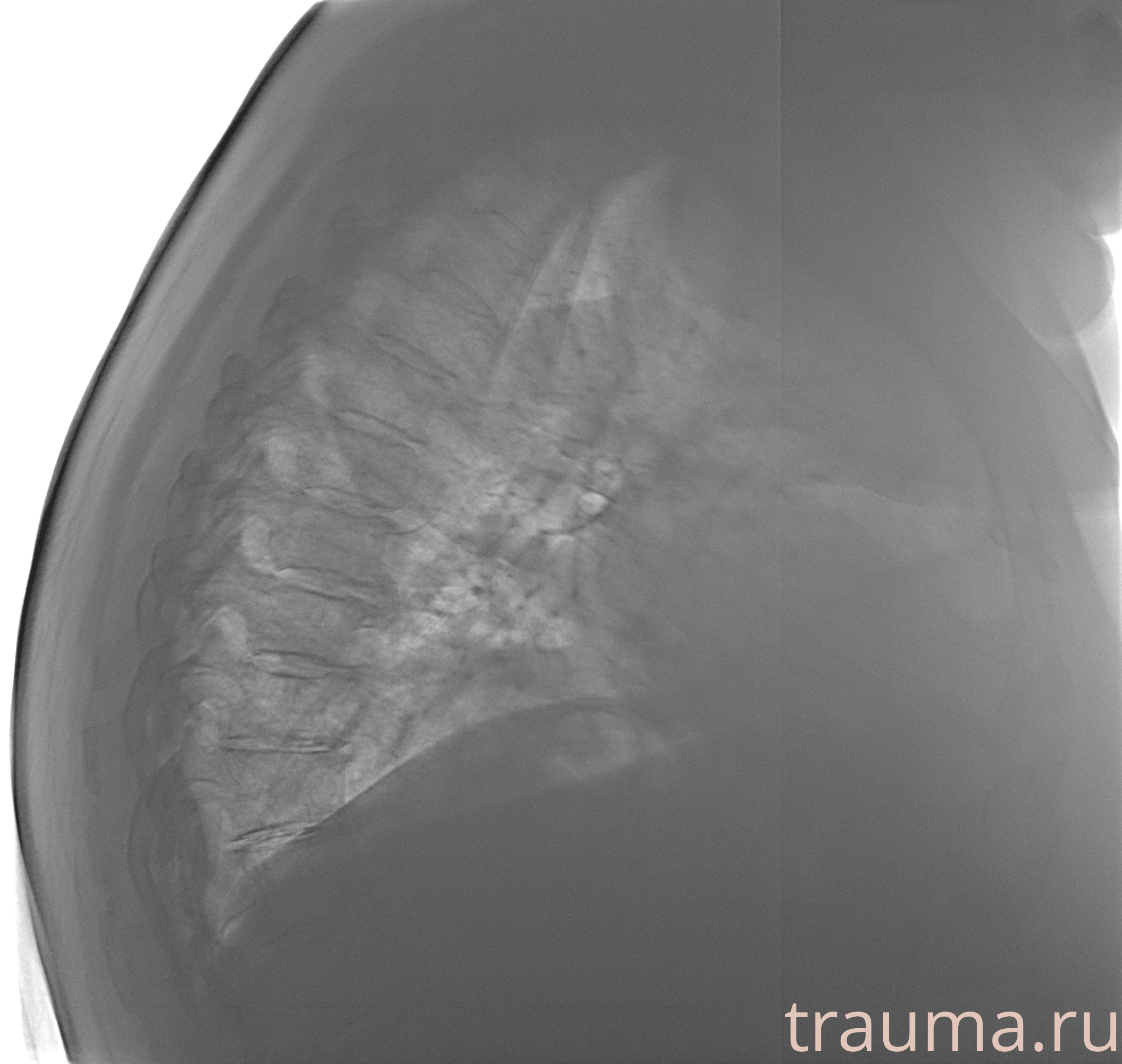 Рентген на дому: по вашему адресу приезжает врач-рентгенолог, травматолог-ортопед с мобильным рентгеновским аппаратом, проводит диагностику травмы или заболевания, делает необходимые рентгенограммы, дает рекомендации по дальнейшему лечению. Получить качественные снимки в домашних условиях возможно благодаря уникальной методике, разработанной МосРентген Центром для института  Склифосовского